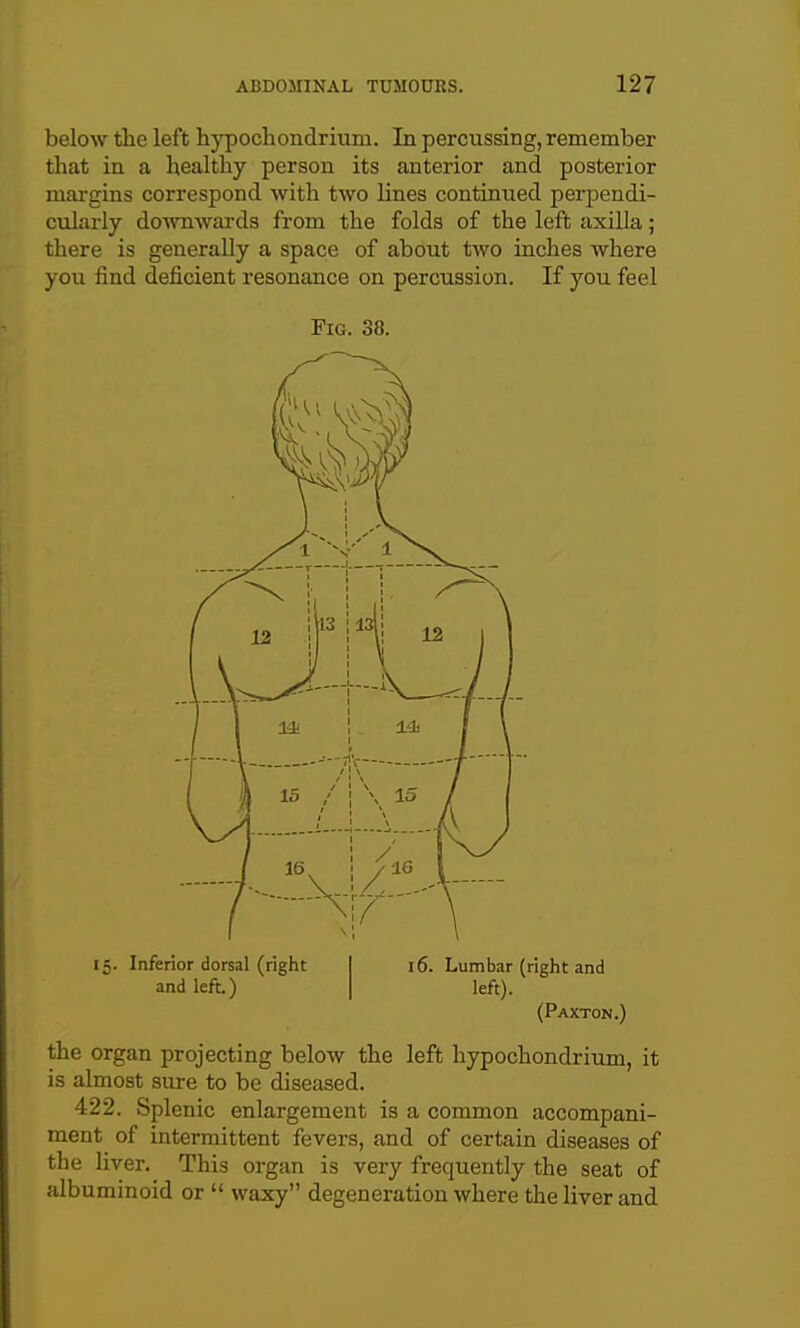 below tlie left hypocliondriuru. In percussing, remember that in a healthy person its anterior and posterior margins correspond with two lines continued perpendi- cularly do^ynwards from the folds of the left axilla; there is generally a space of about two inches where you find deficient resonance on percussion. If you feel Fig. 38. 15. Inferior dorsal (right and left.) 16. Lumbar (right and left). (Paxton.) the organ projecting below the left hypochondrium, it is almost sure to be diseased. 422. Splenic enlargement is a common accompani- ment of intermittent fevers, and of certain diseases of the liver. This organ is very frequently the seat of albuminoid or  waxy degeneration where the liver and