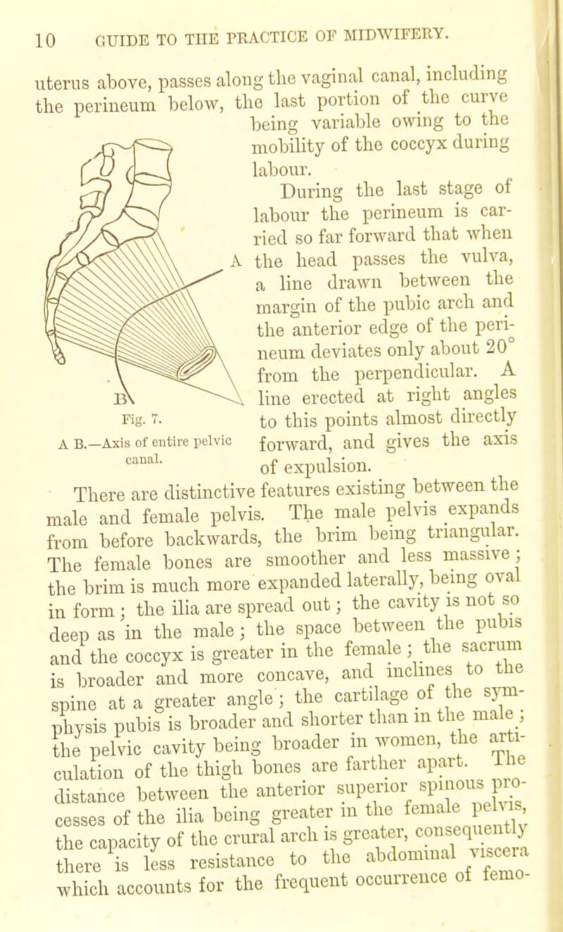 uterus above, passes along the vaginal canal, including the perineum below, the last portion of the curve being variable owing to the mobility of the coccyx during labour. During the last stage of labour the perineum is car- ried so far forward that when the head passes the vulva, a line drawn between the margin of the pubic arch and the anterior edge of the peri- neum deviates only about 20° from the perpendicular. A line erected at right angles to this points almost dkectly forward, and gives the axis of expulsion. There are distinctive features existing between the male and female pelvis. The male pelvis expands from before backwards, the brim being triangular. The female bones are smoother and less massive ; the brim is much more expanded laterally, being oval in form : the ilia are spread out; the cavity is not so deep as in the male; the space between the pubis and the coccyx is greater in the female ; the sacrum is broader and more concave, and inclines to the spine at a greater angle • the cartilage of the sym- physis pubis is broader and shorter than m the male , the pelvic cavity being broader in women, the arti- culation of the thigh bones are farther apart, ihe distance between the anterior superior sp^j^o^s P cesses of the ilia being greater m the female e is the capacity of the crural arch is greater, consequently theri less resistance to the abdomuial visce.^ which accounts for the frequent occurrence of femo- Fig. 7. A B.—Axis of entire ijelvio canal.