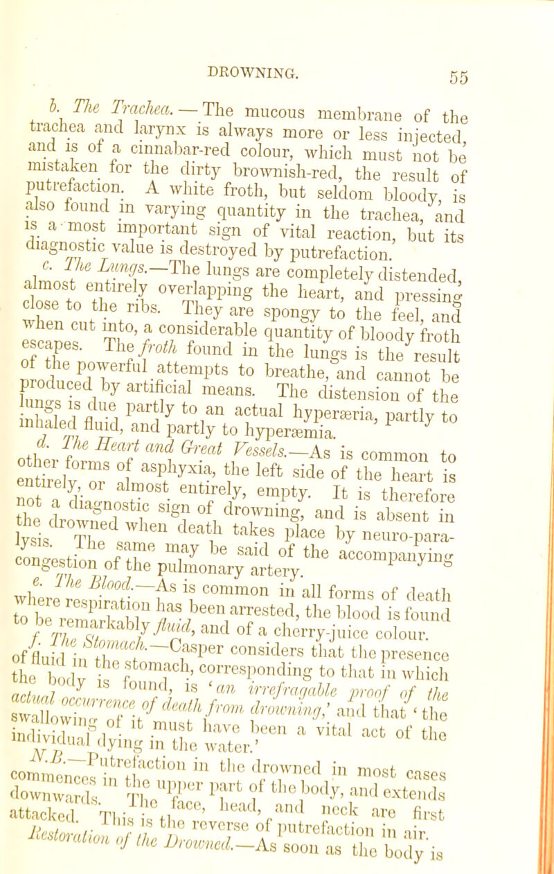 b The Trachea. — The mucous membrane of the trachea and larynx is always more or less injected and is of a cmnabar-red colour, which must not be mistaken for the dirty brownish-red, the result of putrefaction. A white froth, but seldom bloody, is also found in varying quantity in the trachea, and is a most important sign of vital reaction, but its diagnostic value is destroyed by putrefaction. altSLf 7mf ~Th? kmgS are c°mpletely distended, almost entirely overlapping the heart, and pressing close to the ribs. They are spongy to the feel and Sper Tte' i Tf^ °f bl°°™ escapes. Lhe froth found m the lungs is the result P o ucePdTerfUI-f tertS t0 b^hegand cannot produced by artificial means. The distension of the Z^tVaVt yt°r actuaI hypeneria, to inhaled fluid, and partly to hyperemia. J other for/?? ^ ^ f^—As is common to en irelv™ °1 ?e Ieft side of the ^eart is entirely or almost entirely, empty. It is therefore not a diagnostic sign of drowning, and is absent S ysisCb Theeds:mlen ^ i§aCe ^ neto-parS to be renwkably/^, and of a cherry-juice colour o4m n r?~°fSper C°nsiderS thafc t]-Presence the ,lv ™h-' C0rresP°lldi«g to that in which arlJj ¥ H1' 18 an irrefragable proof of the ^^tt^ lavital acfc otthe ^V.-d.—Putrefaction in the drowned in ™OQf „ '* * « Dromvl-to soc, as the body ia
