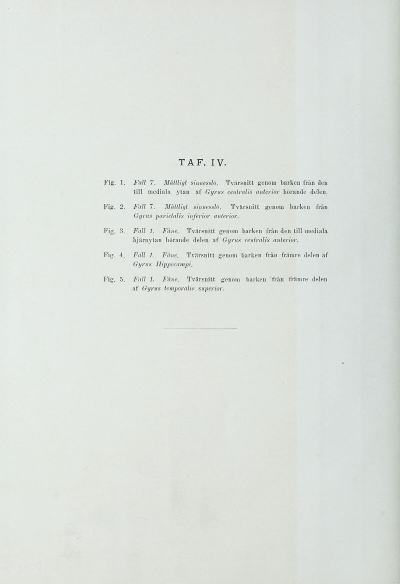Fi?. l Fig'. 2 Fig. 3. Fig. 4. Fig. 5. Fall 7. Mattligt sinnesslo. Tvarsnitt genom barken fran den till mediala ytan af Gyrus centralis anterior horande delen. Fall 7. Mattligt sinnesslo. Tvarsnitt genom barken fran Gyrus parietalis inferior anterior. Fall 1. Fane. Tvarsnitt genom barken fran den till mediala hjarnytan horande delen af Gyrus centralis anterior. Fall 1. Fane. Tvarsnitt genom barken fran framre delen af Gyrus Hippocampi. Fall 1. Fane. Tvarsnitt genom barken fran framre delen af Gyrus temporalis superior.