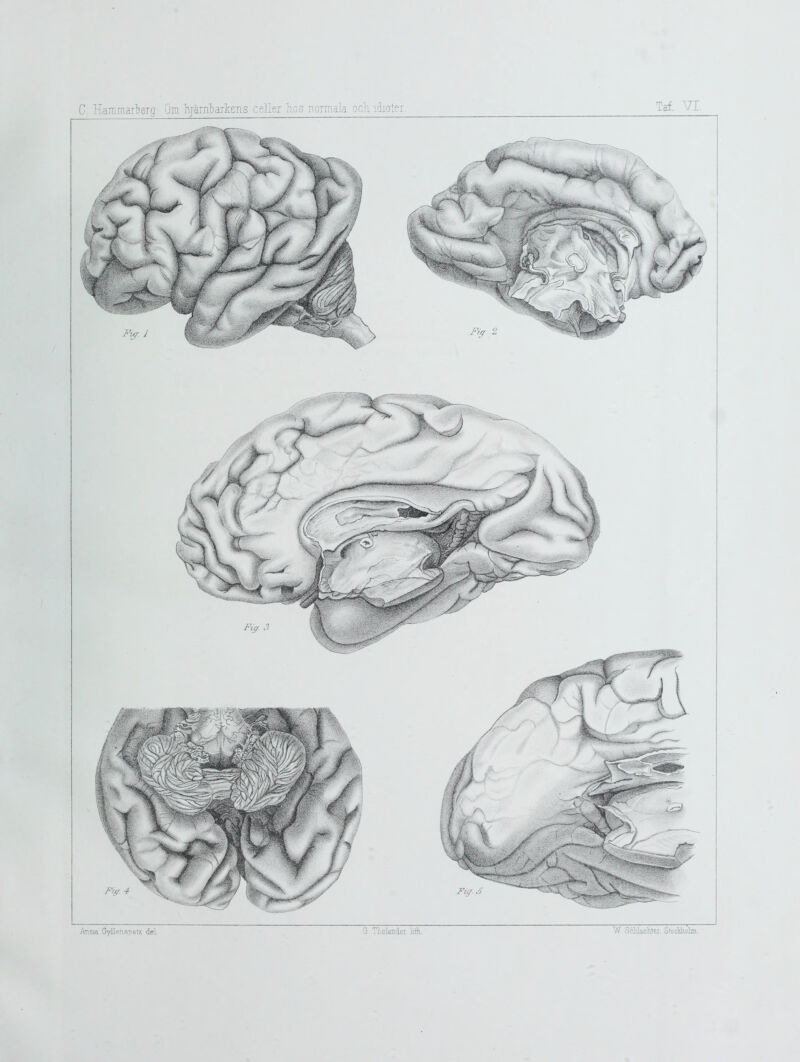 C. Hammaibercr: Om hrarnlarkens celler hos normala och. idiotei Taf. 71 Antia GyU?7! ST>etz del G. Tholander lift.. W ScWachtei. Stockholm