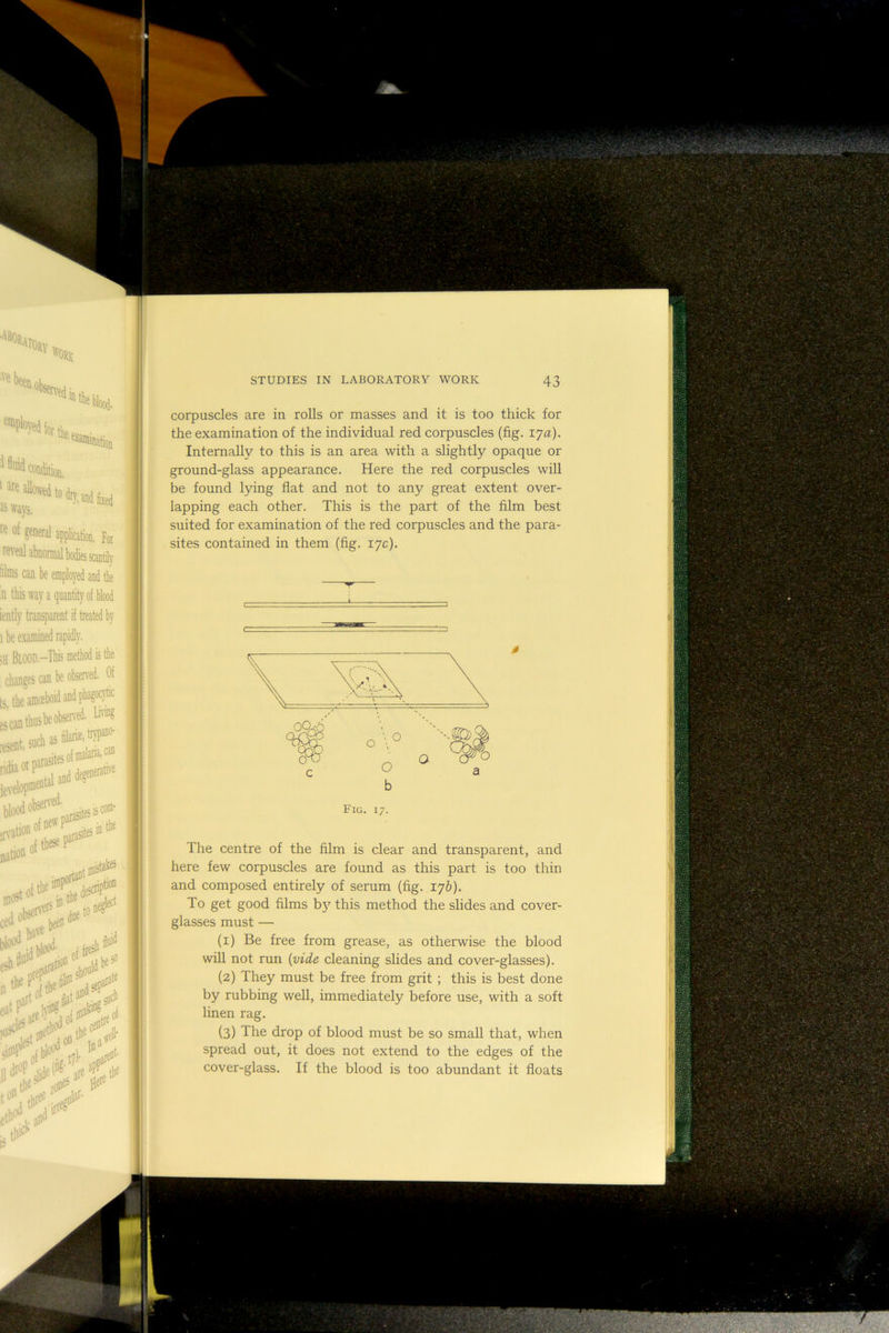 corpuscles are in rolls or masses and it is too thick for the examination of the individual red corpuscles (fig. 17a). Internally to this is an area with a slightly opaque or ground-glass appearance. Here the red corpuscles will be found lying fiat and not to any great extent over- lapping each other. This is the part of the film best suited for examination of the red corpuscles and the para- sites contained in them (fig. 17c). The centre of the film is clear and transparent, and here few corpuscles are found as this part is too thin and composed entirely of serum (fig. 176). To get good films b}' this method the slides and cover- glasses must — (1) Be free from grease, as otherwise the blood will not run {vide cleaning slides and cover-glasses). (2) They must be free from grit ; this is best done by rubbing well, immediately before use, with a soft linen rag. (3) The drop of blood must be so small that, when spread out, it does not extend to the edges of the cover-glass. If the blood is too abundant it floats