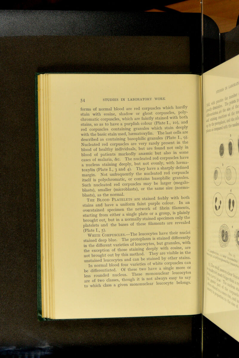 forms of normal blood are red corpuscles whicn nar y stain with eosine, shadow or ghost corpuscles, poly chromatic corpuscles, which are faintly stained with stains, so as to have a purplish colour (Plate I., lo), an red corpuscles containing granules which stain deeply with the basic stain used, hsematoxylin. The last cells are described as containing basophilic granules (Plate I., 9)- Nucleated red corpuscles are very rarely present m the blood of healthy individuals, but are found not only m blood of patients markedly ancemic but also m some cases of malaria, &c. The nucleated red corpuscles have a nucleus staining deeply, but not evenly, with luema- toxylin (Plate I., 3 and 4). They have a sharply defined margin. Not unfrequently the nucleated red corpuscle itself is polychromatic, or contains basophilic granules. Such nucleated red corpuscles may be larger (megalo- blasts), smaller (microblasts), or the same size (normo- blasts), as the normal. The Blood Platelets are stained feebly with both stains and have a uniform faint purple colour In an overstained specimen the network of fibrin filaments, starting from either a single plate or a group, is plain y brought out, but in a normally stained specimen only the platelets and the bases of these filaments are revealed (Plate I., 5). . , • White Corpuscles.—The leucocytes have then nucie stained deep blue. The protoplasm is stained different y in the different varieties of leucocytes, but granules, with the exception of those staining deeply with eosme, are not brought out by this method. They are visible m the unstained leucocytes and can be stained by other stains. In normal blood four varieties of white corpuscles can be differentiated. Of these two have a single more or less rounded nucleus. These mononuclear leucocytes are of two classes, though it is not always easy to say to which class a given mononuclear leucocyte belongs.