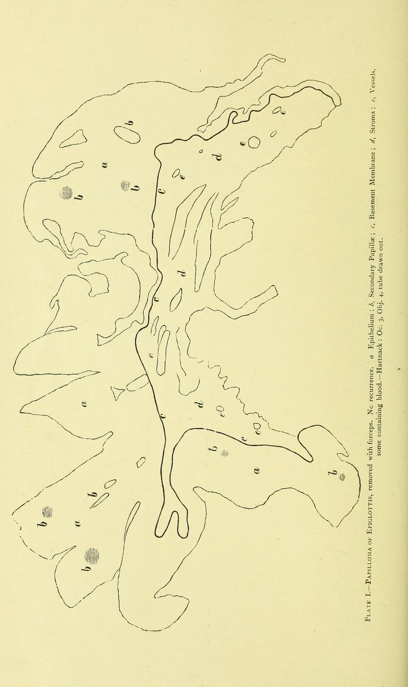 some containing blood.—Hartnack : Oc. 3, Obj. 4, tube drawn out.