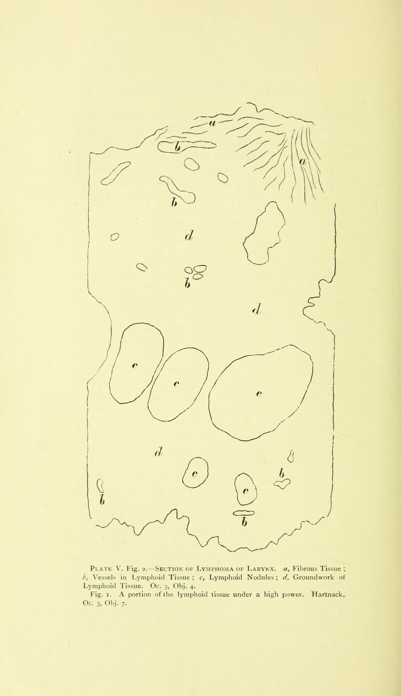 b, Vessels in Lymphoid Tissue ; c, Lymphoid Nodules; d, Groundwork of Lymphoid Tissue. Oc. 3, Obj. 4. Fig. 1. A portion of the lymphoid tissue under a high power. Hartnack,. Oc. 3, Obj. 7.