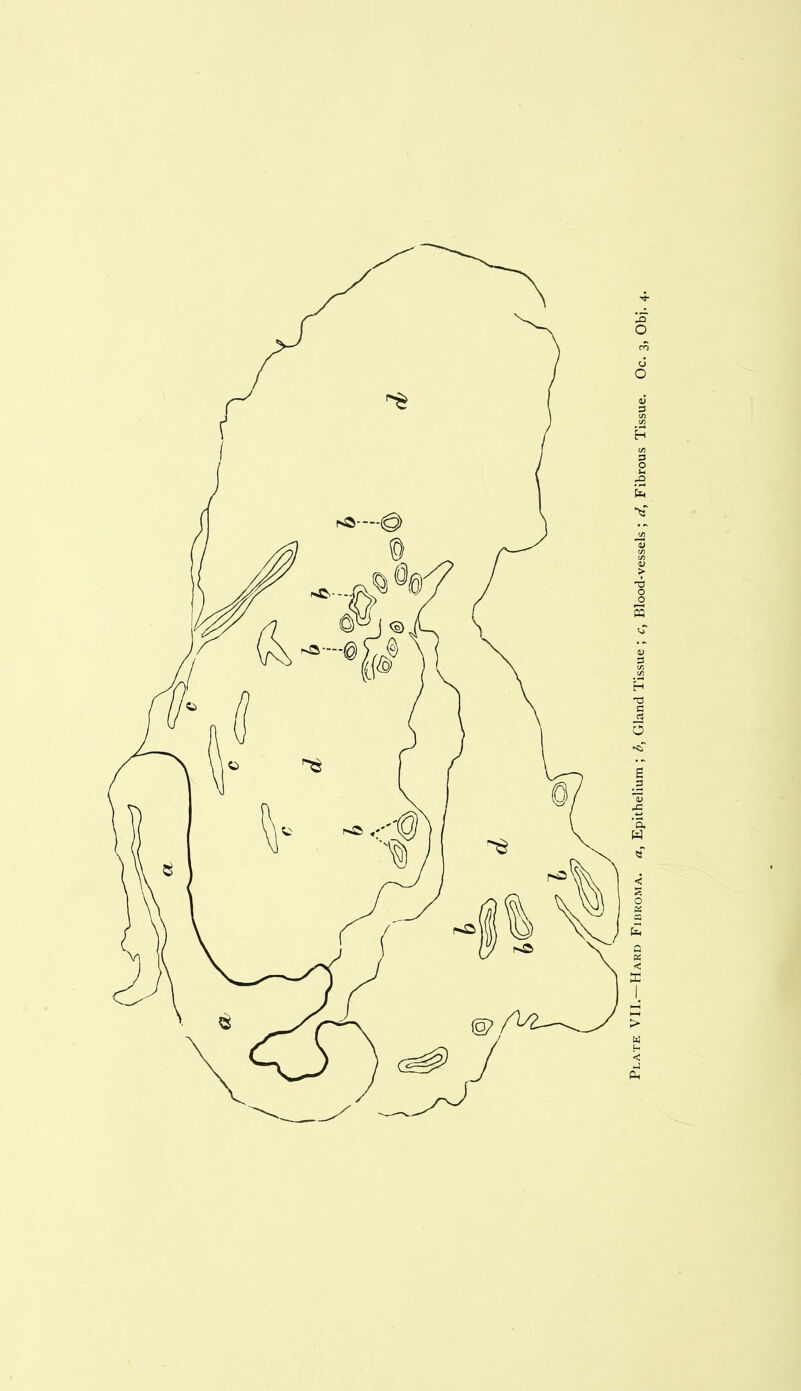 Plate VII.—Hard Fibroma, a, Epithelium ; b, Gland Tissue ; c, Blood-vessels ; d, Fibrous Tissue. Oc. 3, Obj.