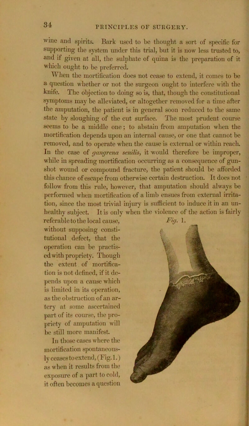 wine and spirits. Bark used to be thought a sort of specific for supporting the system under tiiis trial, but it is now less trusted to, and if given at all, the sidphate of quina is the preparation of it wliich ought to be preferred. When the mortification does not cease to extend, it comes to be a question whether or not the simgeon ought to interfere with the knife. The objection to doing so is, that, though the constitutional symj)toms may be alleviated, or altogether removed for a time after the amputation, the patient is in general soon reduced to the same stiite by sloughing of the cut surface. The most prudent course seems to be a middle one; to abstain from amputation when the mortification depends upon an internal cause, or one that eannot be removed, and to operate when the cause is external or within reaclu In the case of (jangrena senilis, it would therefore be improper, w'hile in spreading mortification occurring as a consequence of gim- shot wound or compound fracture, the patient should be afforded this chance of escape from otherwise certain destruction. It does not follow from this rule, however, that amputation should alw'ays be performed when mortification of a limb ensues from external irrita- tion, since the most trivial injury is sufficient to induce it in an un- healthy subject. It is only when the violence of the action is fairly referable to the local cause, without supposing consti- tutional defect, that the operation can be practis- ed with propriety. Though the extent of mortifica- tion is not defined, if it de- j)ends u])on a cause Avhich is limited in its operation, as the obstruction of an ar- tery at some ascertained part of its course, the jjro- priety of amjjutation w ill be still more manifest. In those cases where the mortification spontaneous- ly ceases to extend, (Fig. 1.) as when it results from the exposure of a part to cold, it often becomes a question