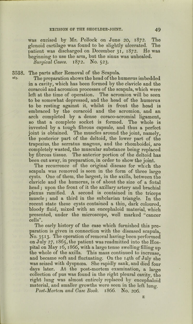 was excised by Mr, Pollock on June 20, 1872. The glenoid cartilage was found to be slightly ulcerated. The patient was discharged on December 31, 1872. He was besfinniner to use the arm, but the sinus was unhealed. Surgical Cases. 1872. No. 523* 3538. The parts after Removal of the Scapula. *63. The preparation shows the head of the humerus imbedded in a cavity, which has been formed by the clavicle and the coracoid and acromion processes of the scapula, which were left at the time of operation. The acromion will be seen to be somewhat depressed, and the head of the humerus to be resting against it, whilst in front the head is embraced by the coracoid and the acromion, and an arch completed by a dense coraco-acromial ligament, so that a complete socket is formed. The whole is invested by a tough fibrous capsule, and thus a perfect joint is obtained. The muscles around the joint, namely, the posterior part of the deltoid, the lower part of the trapezius, the serratus magnus, and the rhomboidei, are completely wasted, the muscular substance being replaced by fibrous tissue. The anterior portion of the deltoid has been cut away, in preparation, in order to show the joint. The recurrence of the original disease for which the scapula was removed is seen in the form of three large cysts. One of them, the largest, in the axilla, between the clavicle and the humerus, is of about the size of a fcetal head; upon the front of it the axillary artery and brachial plexus ramified. A second is contained in the triceps muscle ; and a third in the subclavian triangle. In the recent state these cysts contained a thin, dark coloured, bloody fluid, mixed with an encephaloid material, which presented, under the microscope, well marked ‘‘cancer cells”. The early history of the case which furnished this pre- paration is given in connection with the diseased scapula. No. 3513. The operation of removal having been performed on July 27, 1865, the patient was readmitted into the Hos- pital on May 16, 1866, with a large tense swelling filling up the whole of the axilla. This mass continued to increase, and became soft and fluctuating. On the 14th of July she was seized with dyspnoea. She rapidly sank, and died four days later. At the post-mortem examination, a large collection of pus was found in the right pleural cavity, the right lung was almost entirely replaced by encephaloid material, and smaller growths were seen in the left luno*. Post-Mortem and Case Book. 1866. No. 206. E