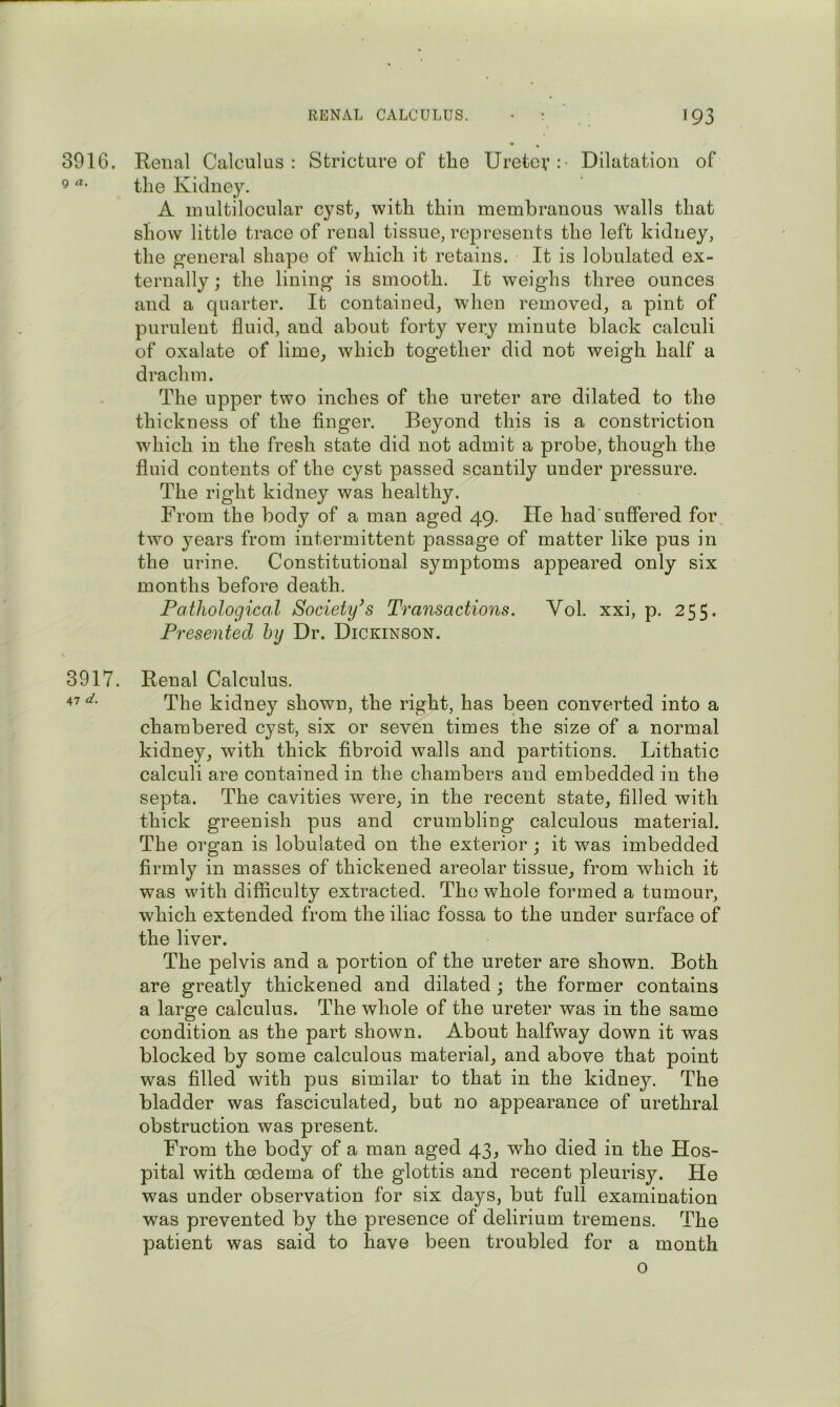3916. Renal Calculus: Stricture of the Uretev: Dilatation of 9 the Kidney. A multilocular cyst, with thin membranous walls that show little trace of renal tissue, represents the left kidney, the general shape of which it retains. It is lobulated ex- ternally ; the lining is smooth. It weighs three ounces and a quarter. It contained, when removed, a pint of purulent fluid, and about forty very minute black calculi of oxalate of lime, which together did not weigh half a drachm. The upper two inches of the ureter are dilated to the thickness of the finger. Beyond this is a constriction which in the fresh state did not admit a probe, though the fluid contents of the cyst passed scantily under pressure. The right kidney was healthy. From the body of a man aged 49. He had’suffered for two years from intermittent passage of matter like pus in the urine. Constitutional symptoms appeared only six months before death. Pathological Society's Transactions. Vol. xxi, p. 255. Presented hy Dr. Dickinson. s 3917. Renal Calculus. The kidney shown, the right, has been converted into a chambered cyst, six or seven times the size of a normal kidney, with thick fibroid walls and partitions. Lithatic calculi are contained in the chambers and embedded in the septa. The cavities were, in the recent state, filled with thick greenish pus and crumbling calculous material. The organ is lobulated on the exterior ; it was imbedded firmly in masses of thickened areolar tissue, from which it was with difficulty extracted. The whole formed a tumour, which extended from the iliac fossa to the under surface of the liver. The pelvis and a portion of the ureter are shown. Both are greatly thickened and dilated ; the former contains a large calculus. The whole of the ureter was in the same condition as the part shown. About halfway down it was blocked by some calculous material, and above that point was filled with pus similar to that in the kidney. The bladder was fasciculated, but no appearance of urethral obstruction was present. From the body of a man aged 43, who died in the Hos- pital with oedema of the glottis and recent pleurisy. He was under observation for six days, but full examination was prevented by the presence of delirium tremens. The patient was said to have been troubled for a month o