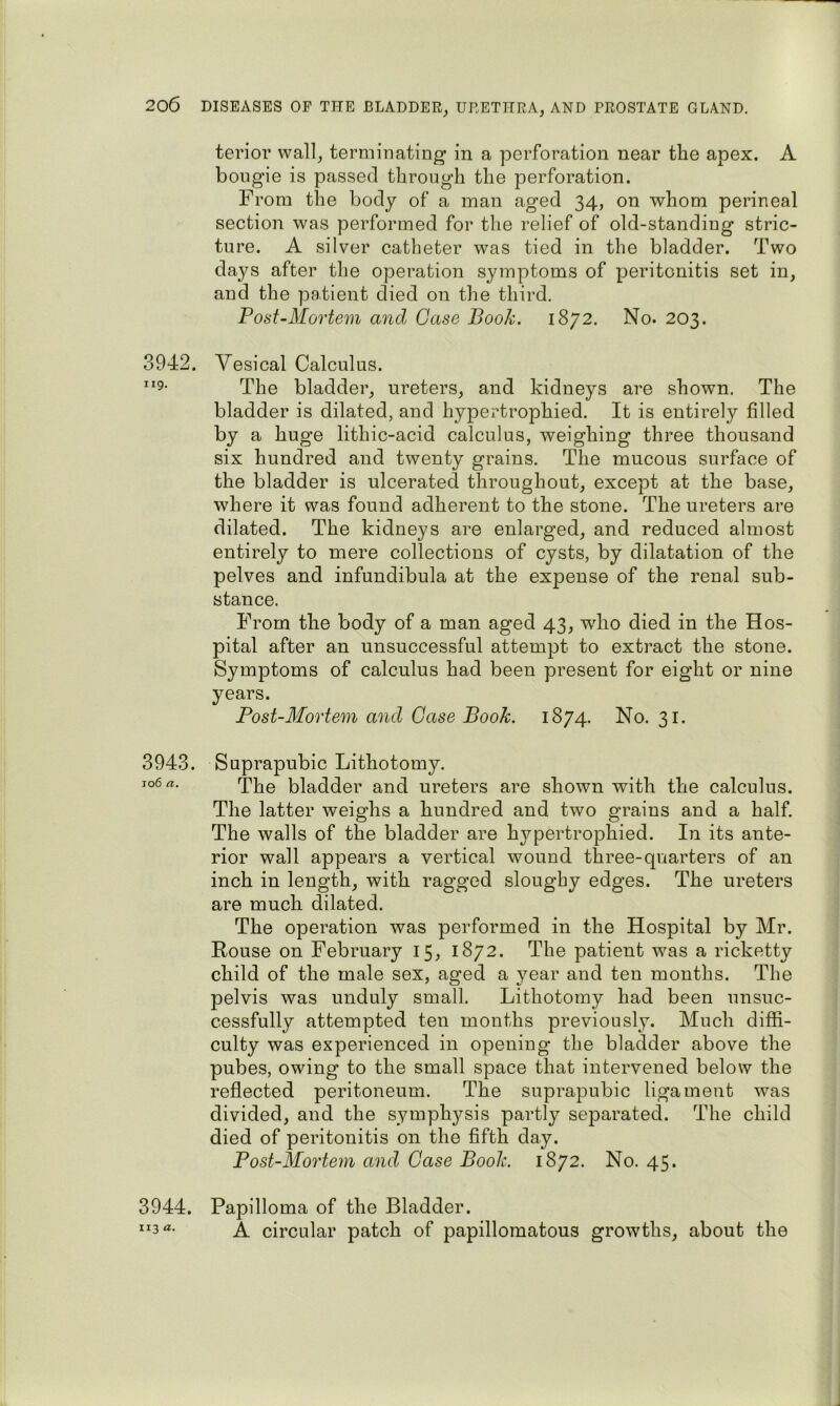 terior wall, terminating in a perforation near the apex. A bougie is passed through the perforation. From the body of a man aged 34, on whom perineal section was performed for the relief of old-standing stric- ture. A silver catheter was tied in the bladder. Two days after the operation symptoms of peritonitis set in, and the patient died on the third. Post-Mortem and Case Book. 1872. No. 203. 3942. Vesical Calculus. “9- The bladder, ureters, and kidneys are shown. The bladder is dilated, and hypertrophied. It is entirely filled by a huge lithic-acid calculus, weighing three thousand six hundred and twenty grains. The mucous surface of the bladder is ulcerated throughout, except at the base, where it was found adherent to the stone. The ureters are dilated. The kidneys are enlarged, and reduced almost entirely to mere collections of cysts, by dilatation of the pelves and infundibula at the expense of the renal sub- stance. From the body of a man aged 43, who died in the Hos- pital after an unsuccessful attempt to extract the stone. Symptoms of calculus had been present for eight or nine years. Post-Mortem and Case Book. 1874. No. 31. 3943. Suprapubic Lithotomy. jo6a. The bladder and ureters are shown with the calculus. The latter weighs a hundred and two grains and a half. The walls of the bladder are hj^pertrophied. In its ante- rior wall appears a vertical wound three-quarters of an inch in length, with ragged slougby edges. The ureters are much dilated. The operation was performed in the Hospital by Mr. Rouse on February 15, 1872. The patient was a ricketty child of the male sex, aged a year and ten months. The pelvis was unduly small. Lithotomy had been unsuc- cessfully attempted ten months previously. Much diffi- culty was experienced in opening the bladder above the pubes, owing to the small space that intervened below the reflected peritoneum. The suprapubic ligament was divided, and the symphysis partly separated. The child died of peritonitis on the fifth day. Post-Mortem and Case Book. 1872. No. 45. 3944. Papilloma of the Bladder. A circular patch of papillomatous growths, about the 113 a.