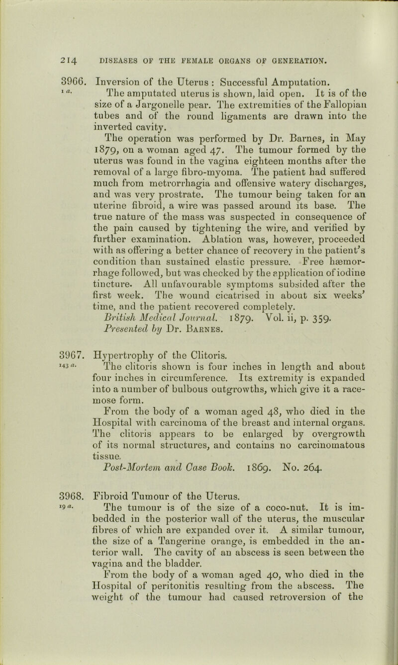 3906. Inversion of the Uterus : Successful Amputation. ^ The amputated uterus is shown, laid open. It is of the size of a Jargonelle pear. The extremities of the Fallopian tubes and of the round ligaments are drawn into the inverted cavity. The operation was performed by Dr. Barnes, in May 1879, on a woman aged 47. The tumour formed by the uterus was found in the vagina eighteen months after the removal of a large fibro-myoma. The patient had suffered much from metrorrhagia and offensive watery discharges, and was very prostrate. The tumour being taken for an uterine fibroid, a wire was passed around its base. The true nature of the mass was suspected in consequence of the pain caused by tightening the wire, and verified by further examination. Ablation was, however, proceeded with as offering a better chance of recovery in the patienFs condition than sustained elastic pressure. Free haemor- rhage followed, but was checked by the application of iodine tincture. All unfavourable symptoms subsided after the first week. The wound cicatrised in about six weeks^ time, and the patient recovered completely. British Medical Journal. 1879. Vol. ii, p. 359. Presented hy Dr. Barnes. 3967. Hypertrophy of the Clitoris. 143 rt. clitoris shown is four inches in length and about four inches in circumference. Its extremity is expanded into a number of bulbous outgrowths, which give it a race- mose form. From the body of a woman aged 48, who died in the Hospital with carcinoma of the breast and internal organs. The clitoris appears to be enlarged by overgrowth of its normal structures, and contains no carcinomatous tissue, Post-Mortem and Case Book. 1869. No. 264. 3968. Fibroid Tumour of the Uterus. 19 «• The tumour is of the size of a coco-nut. It is im- bedded in the posterior wall of the uterus, the muscular fibres of which are expanded over it. A similar tumour, the size of a Tangerine orange, is embedded in the an- terior wall. The cavity of an abscess is seen between the vagina and the bladder. From the body of a woman aged 40, who died in the Hospital of peritonitis resulting from the abscess. The weight of the tumour had caused retroversion of the
