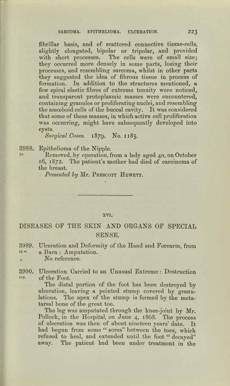 fibrillar basis, and of scattered connective tissue-cells, slightly elongated, bipolar or tripolar, and provided with short processes. The cells were of small size; they occurred more densely in some parts, losing their processes, and resembling sarcoma, whilst in other parts they suggested the idea of fibrous tissue in process of formation. In addition to the structures mentioned, a few spiral elastic fibres of extreme tenuity were noticed, and transparent protoplasmic masses were encountered, containing’ granules or proliferating nuclei, and resembling the amoeboid cells of the buccal cavity. It was considered that some of these masses, in which active cell proliferation was occurring, might have subsequently developed into cysts. Surgical Cases. 1879. No. 1185. 3988. Epithelioma of the Nipple. 5^- Removed, by operation, from a lady aged 40, on October 16, 1872. The patient’s mother had died of carcinoma of the breast. Presented hy Mr. Prescott Hewett. XVI. DISEASES OF THE SKIN AND ORGANS OF SPECIAL SENSE. 3989. Ulceration and Deformity of the Hand and Forearm, from 55 a Burn : Amputation. « No reference. 3990. Ulceration Carried to an Unusual Extreme : Destruction 107. of the Foot. The distal portion of the foot has been destroyed by ulceration, leaving a pointed stump covered by granu- lations. The apex of the stump is formed by the meta- tarsal bone of the great toe. The leg was amputated through the knee-joint by Mr. Pollock, in the Hospital, on June 4, 1868. The process of ulceration was then of about nineteen years’ date. It had begun from some sores” between the toes, which refused to heal, and extended until the foot decayed” away. The patient had been under treatment in the