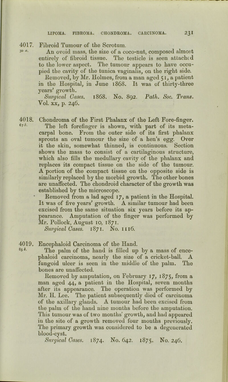 4017. 30 a. 4018. b. 4019, 8s i. Fibroid Tumour of the Scrotum. An ovoid mass, the size of a coco-nut, composed almost entirely of fibroid tissue. The testicle is seen attached to the lower aspect. The tumour appears to have occu- pied the cavity of the tunica vaginalis, on the right side. Kemoved, by Mr. Holmes, from a man aged 51, a patient in the Hospital, in June 1868. It was of thirty-three years^ growth. Surgical Gases. 1868. No. 892. Path. Soc. Trans. Vol. XX, p. 246. Chondroma of the First Phalanx of the Left Fore-finger. The left forefinger is shown, with part of its meta- carpal bone. From the outer side of its first phalanx sprouts an oval tumour the size of a hen’s egg. Over it the skin, somewhat thinned, is continuous. Section shows the mass to consist of a cartilaginous structure, which also fills the medullary cavity of the phalanx and replaces its compact tissue on the side of the tumour. A portion of the compact tissue on the opposite side is similarly replaced by the morbid growth. The other bones are unaffected. The chondroid character of the growth was established by the microscope. Removed from a lad aged 17, a patient in the Hospital. It was of five years^ growth. A similar tumour had been excised from the same situation six years before its ap- pearance. Amputation of the finger was performed by Mr. Pollock, August 10, 1871. Surgical Cases. 1871. No. Hi6. Encephaloid Carcinoma of the Hand. The palm of the hand is filled up by a mass of ence- phaloid carcinoma, nearly the size of a cricket-ball. A fungoid ulcer is seen in the middle of the palm. The bones are unaffected. Removed by amputation, on February 17, 1875, from a man aged 44, a patient in the Hospital, seven months after its appearance. The operation was performed by Mr. H. Lee. The patient subsequently died of carcinoma of the axillary glands. A tumour had been excised from the palm of the hand nine months before the amputation. This tumour was of two months’ growth, and had appeared in the site of a growth removed four months previously. The primary growth was considered to be a degenerated blood-cyst. Surgical Gases. 1874. No. 642. 1875. No. 246.