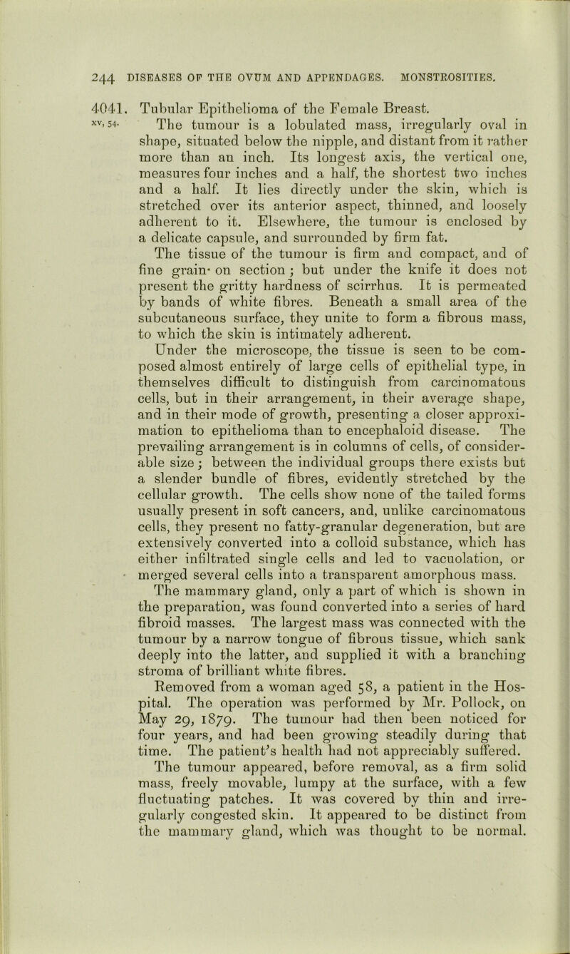 4041. Tubular Epithelioma of the Female Breast. XV, 54. 4''p0 tumour is a lobulated mass, irregularly oval in shape, situated below the nipple, and distant from it rather more than an inch. Its longest axis, the vertical one, measures four inches and a half, the shortest two inches and a half. It lies directly under the skin, which is stretched over its anterior aspect, thinned, and loosely adherent to it. Elsewhere, the tumour is enclosed by a delicate capsule, and surrounded by firm fat. The tissue of the tumour is firm and compact, and of fine grain* on section ; but under the knife it does not present the gritty hardness of scirrhus. It is permeated by bands of white fibres. Beneath a small area of the subcutaneous surface, they unite to form a fibrous mass, to which the skin is intimately adherent. Under the microscope, the tissue is seen to be com- posed almost entirely of large cells of epithelial type, in themselves difficult to distinguish from carcinomatous cells, but in their arrangement, in their average shape, and in their mode of growth, presenting a closer approxi- mation to epithelioma than to encephaloid disease. The prevailing arrangement is in columns of cells, of consider- able size; between the individual groups there exists but a slender bundle of fibres, evidently stretched by the cellular growth. The cells show none of the tailed forms usually present in soft cancers, and, unlike carcinomatous cells, they present no fatty-granular degeneration, but are extensively converted into a colloid substance, which has either infiltrated single cells and led to vacuolation, or • merged several cells into a transparent amorphous mass. The mammary gland, only a part of which is shown in the preparation, was found converted into a series of hard fibroid masses. The largest mass was connected with the tumour by a narrow tongue of fibrous tissue, which sank deeply into the latter, and supplied it with a branching stroma of brilliant white fibres. Removed from a woman aged 58, a patient in the Hos- pital. The operation was performed by Mr. Pollock, on May 29, 1879. tumour had then been noticed for four years, and had been growiug steadily during that time. The patieuPs health had not appreciably suffered. The tumour appeared, before removal, as a firm solid mass, freely movable, lumpy at the surface, with a few fluctuating patches. It was covered by thin and irre- gularly congested skin. It appeared to be distinct from the mammary gland, which was thought to be normal.