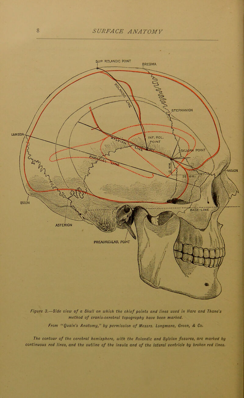 aUR ROLftNDIC POINT BREGMA STEPHAN ION UMSDA- INF. ROL. .POINT iSYLVJAK point NSSIOH INION BASE.-LINE A5TERION preauricular point Figure 3.—Side view of a Shuii on which the chief points and lines used in Hare and Thane's method of cranio-cerebral topography have been marked. From “Quain’s Anatomy, by permission of Messrs. Longmans, Green, & Co. The contour of the cerebral hemisphere, with the Roiandic and Sylvian fissures, are marked by continuous red lines, and the outline of the insula and of the lateral ventricle by broken red lines.