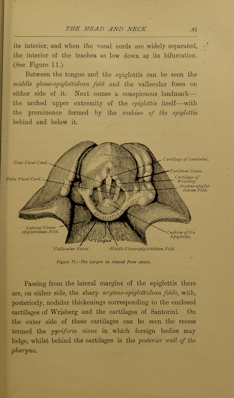 its interior, and when the vocal cords are widely separated, • * the interior of the trachea as low down a? its bifurcation. (See Figure 11.) Between the tongue and the epiglottis can be seen the middle glosso-epiglottidean fold and the vallecular fossa on either side of it. l^^ext comes a conspicuous landmark— the arched upper extremity of the epiglottis itself—with the prominence formed by the cushion of the epiglottis behind and below it. True Vocal Cord. False Vocal Cord. Cartilage of Santorini. Pyriform Sinus. Cartilage of Wrisberg. A ryteno-epiglot- tidcan Fold. Cushion of the Epiglottis. Lateral Glosso- epiglottidean Fold. Vallecular Fossa. Middle Glosso-epiglottidean Fold. Figure 11.—The Larynx as viewed from above. Passing from the lateral margins of the epiglottis there are, on either side, the sharp aryteno-epiglottidean folds, with, posteriorly, nodular thickenings corresponding to the enclosed cartilages of Wrisberg and the cartilages of Santorini. On the outer side of these cartilages can be seen the recess termed the pyriform sinus in which foreign bodies may lodge, whilst behind the cartilages is the posterior wall of the pharynx.