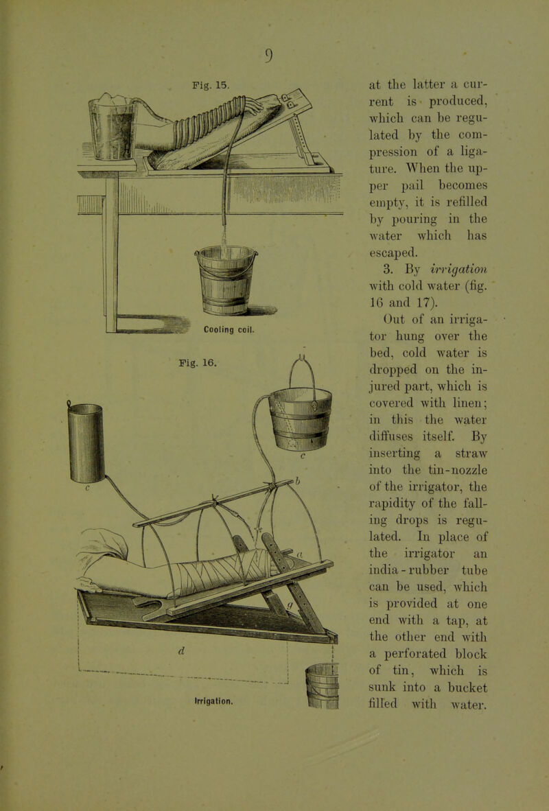 Pig. 15. Irrigation. at the latter a cur- rent is produced, which can be regu- lated by the com- pression of a liga- ture. When the up- per pail becomes empty, it is refilled by pouring in the water which has escaped. 3. By irrigation with cold water (fig. 16 and 17). Out of an irriga- tor hung over the bed, cold water is dropped on the in- jured part, which is covered with linen; in this the water diffuses itself. By inserting a straw into the tin-nozzle of the irrigator, the rapidity of the fall- ing drops is regu- lated. In place of the irrigator an india - rubb er tub e can be used, which is provided at one end with a tap, at the other end with a perforated block of tin, which is sunk into a bucket filled with water.