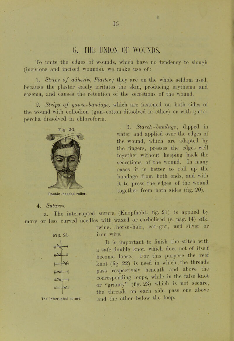G. THE UNION OF WOUNDS. To unite the edges of wounds, which have no tendency to slough (incisions and incised wounds), we make use of: 1. Strips of adhesive Plaster; they are on the whole seldom used, because the plaster easily irritates the skin, producing erythema and eczema, and causes the retention of the secretions of the wound. 2. Strips of gauze-bandage, which are fastened on both sides of the wound with collodion (gun-cotton dissolved in ether) or with gutta- percha dissolved in chloroform. 3. Starch - bandage, dipped in water and applied over the edges of the wound, which are adapted by the fingers, presses the edges well together without keeping back the secretions of the wound. In many cases it is better to roll up the bandage from both ends, and with it to press the edges of the wound together from both sides (fig. 20). Double-headed roller. ° K ° Fig. 20. Sutures, a. The interrupted suture (Knopfnaht, fig. 21) is applied by Fig. 21. more or less curved needles with waxed or carbolised (s. pag. 14) silk, twine, horse-hair, cat-gut, and silver or iron wire. It is important to finish the stitch with a safe double knot, which does not of itself become loose. For this purpose the reef knot (fig. 22) is used in which the threads pass respectively beneath and above the • corresponding loops, while in the false knot or granny (fig. 23) which is not secure, the threads on each side pass one above The interrupted suture. an<J the Other below the loop. i—±&