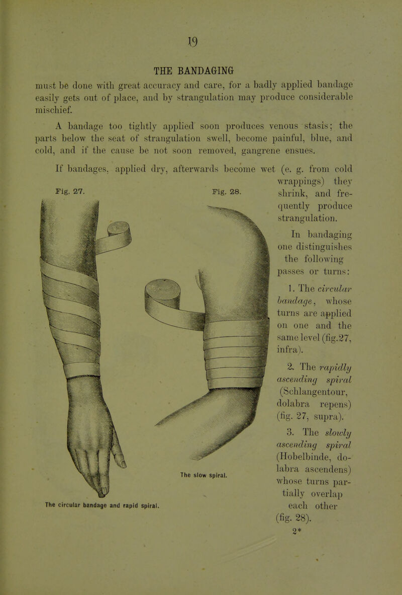 THE BANDAGING must be done with great accuracy and care, for a badly applied bandage easily gets out of place, and by strangulation may produce considerable mischief. A bandage too tightly applied soon produces venous stasis; the parts below the seat of strangulation swell, become painful, blue, and cold, and if the cause be not soon removed, gangrene ensues. If bandages, applied dry. afterwards become wet (e. g. from cold wrappings) they Fig. 27. Fig. 28. shrink, and fre- quently produce strangulation. In bandaging one distinguishes the following passes or turns: 1. The circular bandage, whose turns are applied on one and the same level (fig.27, infra). 2. The rapidly ascending spiral (Schlangentour, dolabra repens) (fig. 27, supra). 3. The slowly ascending spiral (Hobelbinde, do- labra ascendens) Whose turns par- tially overlap The circular bandage and rapid spiral. each Other (fig. 28). 2*