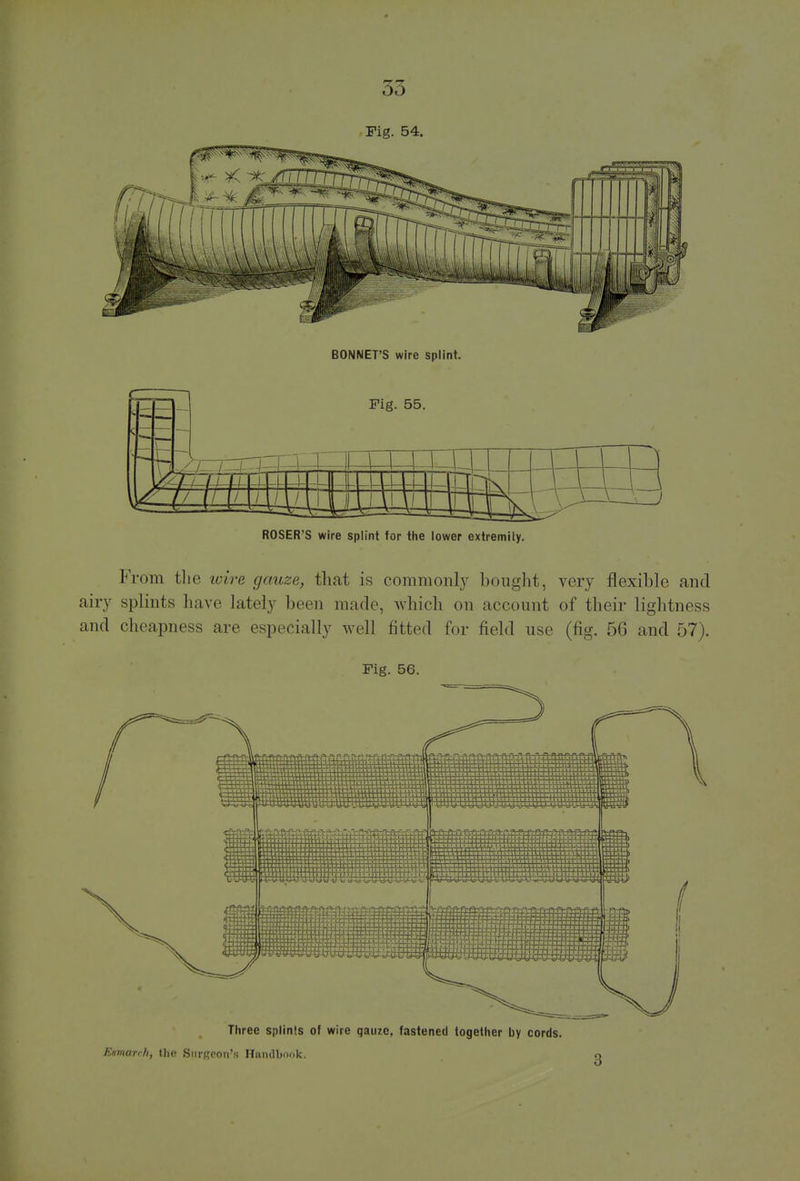 BONNET'S wire splint. Fig. 55. ROSER'S wire splint for the lower extremity. From the wire gauze, that is commonly bought, very flexible and airy splints have lately been made, which on account of their lightness and cheapness are especially well fitted for field use (fig. 56 and 57). Fig. 56. Three splints of wire qauzc, fastened together by cords. Etmarrh, the SnrRCon's Handbook.
