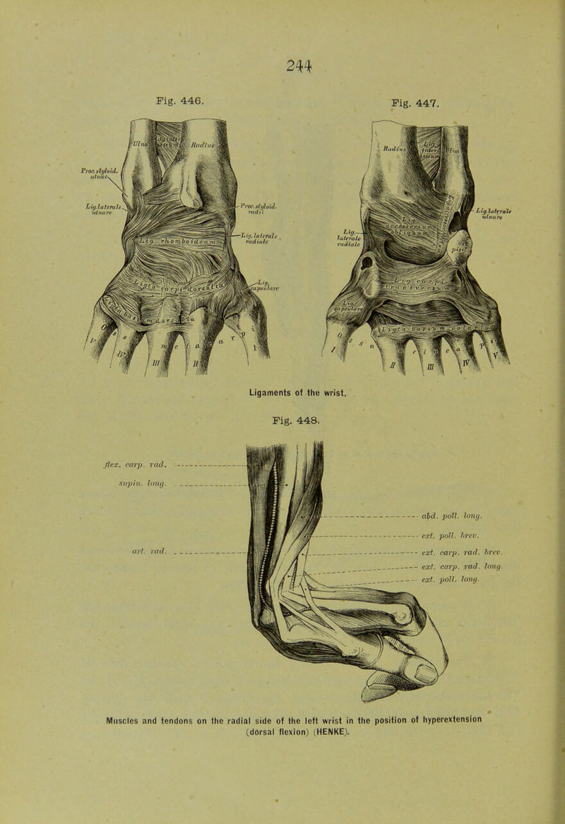 Muscles and tendons on the radial side of the left wrist in the position of hyperextension (dorsal flexion) (HENKE).
