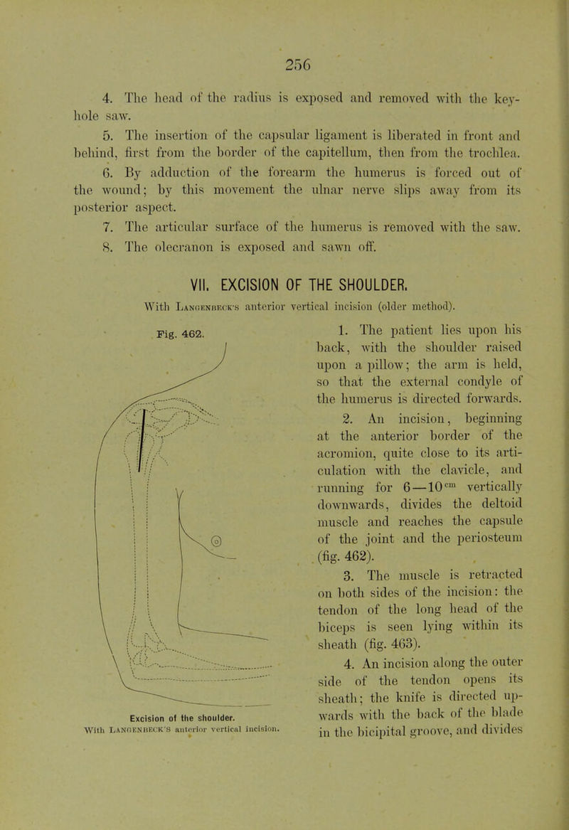 4. The head of the radius is exposed and removed with the key- hole saw. 5. The insertion of the capsular ligament is liberated in front and behind, first from the border of the capitellum, then from the trochlea. 6. By adduction of the forearm the humerus is forced out of the wound; by this movement the ulnar nerve slips away from its posterior aspect. 7. The articular surface of the humerus is removed with the saw. 8. The olecranon is exposed and sawn off. VII. EXCISION OF THE SHOULDER. With Langekbeck-s anterior vortical incision (older method). Fig. 462. Excision of the shoulder. With LANfl EN BECK'S anterior vertical incision. 1. The patient lies upon his back, with the shoulder raised upon a pillow; the arm is held, so that the external condyle of the humerus is directed forwards. 2. An incision, beginning at the anterior border of the acromion, quite close to its arti- culation with the clavicle, and running for 6—10cm vertically downwards, divides the deltoid muscle and reaches the capsule of the joint and the periosteum . (fig. 462). 3. The muscle is retracted on both sides of the incision: the tendon of the long head of the biceps is seen lying within its sheath (fig. 463). 4. An incision along the outer side of the tendon opens its sheath; the knife is directed up- wards with the back of the blade in the bicipital groove, and divides