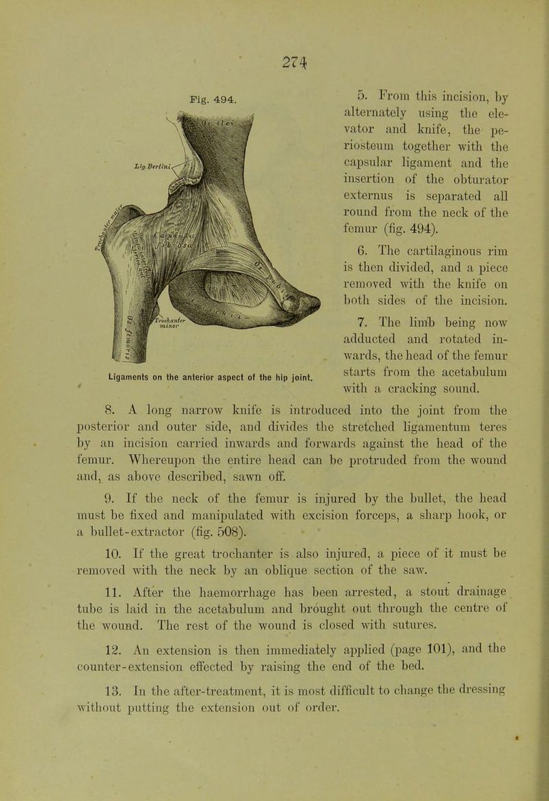 Fig. 494. 5. From this incision, by alternately using the ele- vator and knife, the pe- riosteum together with the capsular ligament and the insertion of the obturator externus is separated all round from the neck of the femur (fig. 494). 6. The cartilaginous rim is then divided, and a piece removed with the knife on both sides of the incision. 7. The limb being now adducted and rotated in- wards, the head of the femur Ligaments on the anterior aspect of the hip joint. starts from the acetabulum with a cracking sound. 8. A long narrow knife is introduced into the joint from the posterior and outer side, and divides the stretched ligamentum teres by an incision carried inwards and forwards against the head of the femur. Whereupon the entire head can be protruded from the wound and, as above described, sawn off. 9. If the neck of the femur is injured by the bullet, the head must be fixed and manipulated with excision forceps, a sharp hook, or a bullet-extractor (fig. 508). 10. If the great trochanter is also injured, a piece of it must be removed with the neck by an oblique section of the saw. 11. After the haemorrhage has been arrested, a stout drainage tube is laid in the acetabulum and brought out through the centre of the wound. The rest of the wound is closed with sutures. 12. An extension is then immediately applied (page 101), and the counter-extension effected by raising the end of the bed. 13. In the after-treatment, it is most difficult to change the dressing without putting the extension out of order.