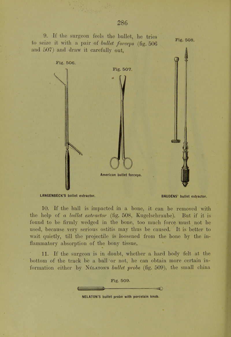 9. If the sin-eon feels the bullet, he tries to seize it with a pair of bullet forceps (fig. 506 and 507) and draw it carefully out, Fig. 506. Fig. 508. Fig. 507. American bullet forceps. LANGENBECK'S bullet extractor. BAUDENS* bullet extractor. 10. If the ball is impacted in a bone, it can be removed with the help of a bullet extractor (fig. 508, Kugelschraube). But if it is found to be firmly wedged in the bone, too much force must not be used, because very serious ostitis may thus be caused. It is better to wait cpiiietly, till the projectile is loosened from the bone by the in- flammatory absorption of the bony tissue. 11. If the surgeon is in doubt, whether a hard body felt at the bottom of the track be a ball or not, he can obtain more certain in- formation either by NiSlaton's bullet probe (fig. 509), the small china Fig. 509. NELATON'S bullet probe with porcelain knob.