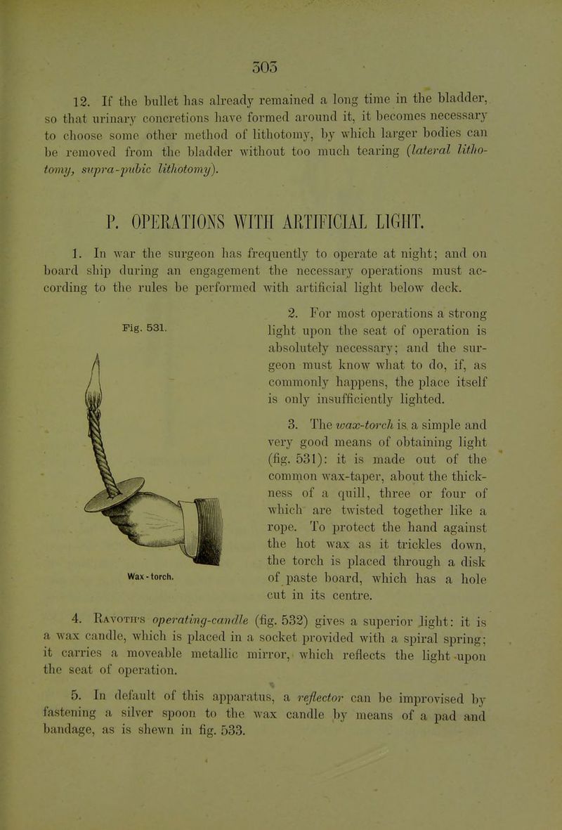505 12. If the bullet has already remained a long time in the bladder, so that urinary concretions have formed around it, it becomes necessary to choose some other method of lithotomy, by which larger bodies can be removed from the bladder without too much tearing (lateral litho- tomy, snpra-puhic lithotomy). P. OPERATIONS WITH ARTIFICIAL LIGHT. I. In war the surgeon has frequently to operate at night; and on board ship during an engagement the necessary operations must ac- cording to the rules be performed with artificial light below deck. Fig. 531. Wax-torch. 2. For most operations a strong light upon the seat of operation is absolutely necessary; and the sur- geon must know what to do, if, as commonly happens, the place itself is only insufficiently lighted. 3. The wax-torch is a simple and very good means of obtaining light (fig. 531): it is made out of the common wax-taper, about the thick- ness of a quill, three or four of which are twisted together like a rope. To protect the hand against the hot wax as it trickles down, the torch is placed through a disk of paste board, which has a hole cut in its centre. 4. Ravoth-s operating-candle (fig. 532) gives a superior light: it is a wax candle, which is placed in a socket provided with a spiral spring; it carries a moveable metallic mirror, i which reflects the light upon the seat of operation. 5. In default of this apparatus, a reflector can be improvised by fastening a silver spoon to the wax candle by means of a pad and