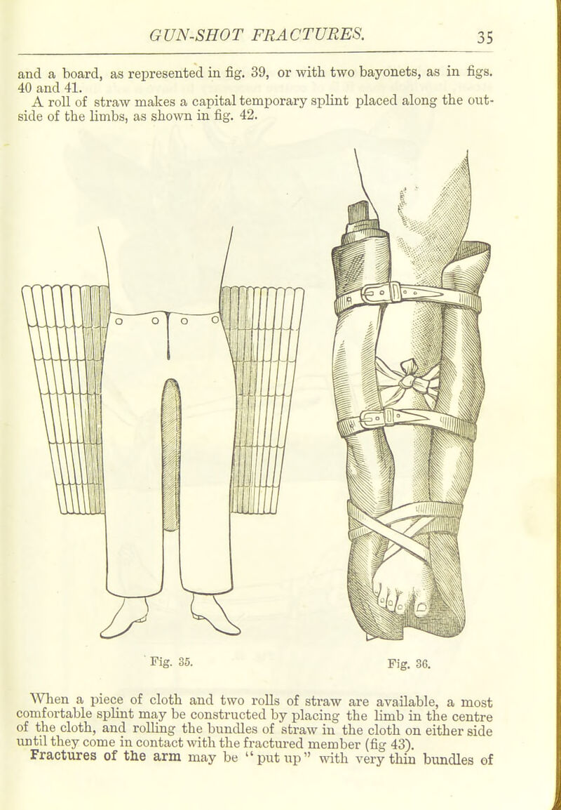 and a board, as represented in fig. 39, or with two bayonets, as in figs. 40 and 41. A roll of straw makes a capital temporary splint placed along the out- side of the limbs, as shown in fig. 42. Fig. 35. Fig. 36. Wlien a piece of cloth and two rolls of straw are available, a most comfortable splint may be constructed by placing the limb in the centre of the cloth, and rolling the bundles of straw in the cloth on either side until they come in contact with the fractured member (fig 43). Fractures of the arm may be put up with very thin bundles of