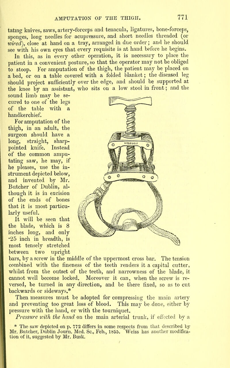 tating knives, saws, artery-forceps and tenacula, ligatures, bone-forceps, sponges, long needles for acupressure, and short needles threaded (or wired), close at hand on a tray, arranged in due order; and he should see with his own eyes that every requisite is at hand before he begins. In this, as in every other operation, it is necessary to place the patient in a convenient posture, so that the operator may not be obliged to stoop. For amputation of the thigh, the patient may be placed on a bed, or on a table covered with a folded blanket; the diseased leg should project sufficiently over the edge, and should be supported at the knee by an assistant, who sits on a low stool in front; and the sound limb may be se- cured to one of the legs of the table with a handkerchief. For amputation of the thigh, in an adult, the surgeon should have a long, straight, sharp- pointed knife. Instead of the common ampu- tating saw, he may, if he pleases, use the in- strument depicted below, and invented by Mr. Butcher of Dublin, al- though it is in excision of the ends of bones that it is most particu- larly useful. It will be seen that the blade, which is 8 inches long, and only •25 inch in breadth, is most tensely stretched between two upright bars, by a screw in the middle of the uppermost cross bar. The tension combined with the fineness of the teeth renders it a capital cutter, whilst from the outset of the teeth, and narrowness of the blade, it cannot well become locked. Moreover it can, when the screw is re- versed, be turned in any direction, and be there fixed, so as to cut backwards or sideways.* Then measures must be adopted for compressing the main ailery and preventing too great loss of blood. This may be done, either by pressure with the hand, or with the tourniquet. Pressure vnth the hand on the main arterial trunk, if eftected by a * The saw depicted on p. 772 differs in some respects from that described by Mr. Butcher, Dublin Journ. Med. Sc., Feb., 1855. Weiss has another modifica- tion of it, suggested by Mr. Busk.