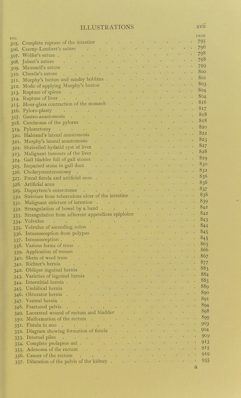 305- 306. 307. 30S. 309- 310. 311- !I2. Complete rupture of the intestine Czerny-Lemhert's suture Wolfer's suture . . ■ • • Jobert's suture .... Maunsell's suture . . • ■ Cheatle's suture .... Murphy's button and sundry bobbins . Mode of applying Murphy's button Rupture of spleen . . . . Rupture of liver .... Hour-glass contraction of the stomach 313. 314. 315 316. Pyloro-plasty 317 318. 319- 320. 321. 322. 323- 324- 325- 328. 329. 330. 333 334 Gastro-anastomosis Carcinoma of the pylorus Pylorectomy Halstead's lateral anastomosis Murphy's lateral anastomosis Shrivelled hydatid cyst of liver Malignant tumours of the liver Gall bladder full of gall stones Impacted stone in gall duct 326. Cholecystenterostomy . 327. Feecal fistula and artificial anus Artificial anus Dupuytren's enterotome Stricture from tuberculous ulcer of the intestine Malignant stricture of intestine . . . • Strangulation of bowel by a band . Strangulation from adherent appendices epiploicse Volvulus 335. Volvulus of ascending colon 336. Intussusception from polypus 337. Intussusception . 338. Various forms of truss . 339. Application of trusses 340. Skein of wool truss 341. Richter's hernia 342. Oblique inguinal hernia 343. Varieties of inguinal hernia 344. Interstitial hernia . 345. Umbilical hernia 346. Obturator hernia . 347. Ventral hernia . 348. Fractured pelvis .... 349. Lacerated wound of rectum and bladder 350. Malformation of the rectum . 351. Fistula in ano ..... 352. Diagram showing formation of fistula 353. Internal piles ..... 354. Complete prolapsus ani . 355. Adenoma of the rectum 356. Cancer of the rectum 357. Dilatation of the pelvis of the kidney . PAGE 795 796 798 798 799 800 801 803 804 804 816 817 818 818 820 822 823 827 828 829 830 832 836 836 837 838 839 842 842 843 844 845 845 865 , 866 , 867 ■ 877 . 883 . 884 . 885 . 889 . 890 . 891 . 894 898 . 899 • 903 . 904 • 9^9 • 913 • 915 • 919 • 935 a