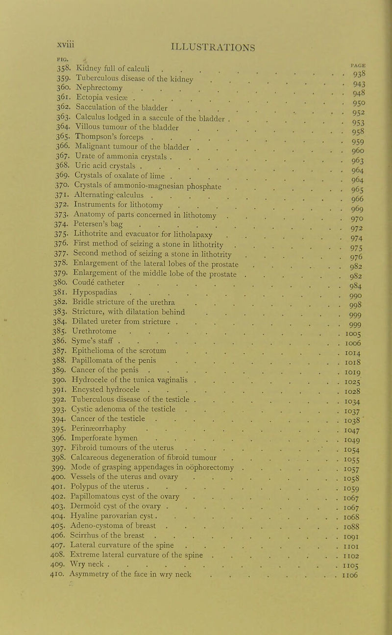 FIG. 358. Kidney full of calculi .... 359. Tuiserculous disease of the kidney 360. Nephrectomy 361. Ectopia vesica: ..... 362. Sacculation of the bladder 363. Calculus lodged in a saccule of the bladder 364. Villous tumour of the bladder 365. Thompson's forceps .... 366. Malignant tumour of the bladder . 367. Urate of ammonia crystals . 368. Uric acid crystals ..... 369. Crystals of oxalate of lime . 370. Crystals of ammonio-magnesian phosphate 371. Alternating calculus .... 372. Instruments for lithotomy 373. Anatomy of parts concerned in lithotomy 374. Petersen's bag ..... 375. Lithotrite and evacuator for litholapaxy 376. First method of seizing a stone in lithotrity . 377. Second method of seizing a stone in lithotrity 378. Enlargement of the lateral lobes of the prostate 379. Enlargement of the middle lobe of the prostate 380. Coude catheter ...... 381. Hypospadias .... 382. Bridle stricture of the urethra 383. Stricture, with dilatation behind 384. Dilated ureter from stricture . 385. Urethrotome .... 386. Syme's staff ..... 387. Epithelioma of the scrotum 388. Papillomata of the penis 389. Cancer of the penis 390. Hydrocele of the tunica vaginalis . 391. Encysted hydrocele . 392. Tuberculous disease of the testicle . 393. Cystic adenoma of the testicle 394. Cancer of the testicle 395. Perinseorrhaphy 396. Imperforate hymen 397. Fibroid tumours of the uterus 398. Calcareous degeneration of fibroid tumour 399. Mode of grasping appendages in oophorectomy 400. Vessels of the uterus and ovary 401. Polypus of the uterus . .... 402. Papillomatous cyst of the ovary 403. Dermoid cyst of the ovary .... 404. Hyaline parovarian cyst..... 405. Adeno-cystoma of breast .... 406. Scirrhus of the breast ..... 407. Lateral curvature of the spine 408. Extreme lateral curvature of the spine . 409. Wry neck ....... 410. Asymmetry of the face in wry neck PAGE • 938 • 943 • 948 • 950 • 952 • 953 • 958 • 959 . 960 ■ 963 • 964 • 964 • 965 . 966 • 969 • 970 • 972 • 974 • 975 ■ 976 . 982 , 9S2 984 990 998 999 999 1005 1006 1014 1018 1019 1025 1028 1034 1037 1038 1047 1049 1054 1055 1057 1058 1059 1067 1067 106S 108S 1091 1101 1102 1105 1106
