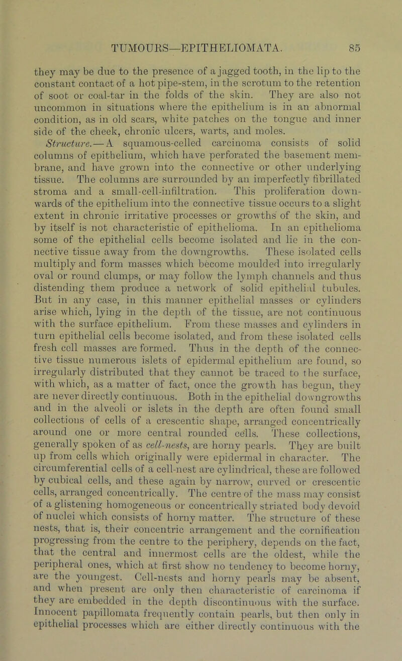 they may be due to the presence of a jagged tooth, in the lip to the constant contact of a hot pipe-stem, in the scrotum to the retention of soot or coal-tar in the folds of the skin. They are also not uncommon in situations where the epithelium is in an abnormal condition, as in old scars, white patches on the tongue and inner side of the cheek, chronic ulcers, warts, and moles. Structure.—A squamous-celled carcinoma consists of solid columns of epithelium, which have perforated the basement mem- brane, and have grown into the connective or other underlying tissue. The columns are surrounded by an imperfectly fibrillated stroma and a small-cell-infiltration. This proliferation down- wards of the epithelium into the connective tissue occurs to a slight extent in chronic irritative processes or growths of the skin, and by itself is not characteristic of epithelioma. In an epithelioma some of the epithelial cells become isolated and lie in the con- nective tissue away from the downgrowths. These isolated cells multiply and form masses which become moulded into irregularly oval or round clumps, or may follow the lymph channels and thus distending them produce a network of solid epithelial tubules. But in any case, in this manner epithelial masses or cylinders arise which, lying in the depth of the tissue, are not continuous with the surface epithelium. From these masses and cylinders in turn epithelial cells become isolated, and from these isolated cells fresh cell masses are formed. Thus in the depth of the connec- tive tissue numerous islets of epidermal epithelium are found, so irregularly distributed that they cannot be traced to the surface, with which, as a matter of fact, once the growth has begun, they are never directly continuous. Both in the epithelial downgrowths and in the alveoli or islets in the depth are often found small collections of cells of a crescentic slmpe, arranged concentrically around one or more central rounded cells. These collections, generally spoken of as cell-nests, are horny pearls. They are built up from cells which originally were epidermal in character. The circumferential cells of a cell-nest are cylindrical, these are followed by cubical cells, and these again by narrow, curved or crescentic cells, arranged concentrically. The centre of the mass may consist of a glistening homogeneous or concentrically striated body devoid of nuclei which consists of horny matter. The structure of these nests, that is, their concentric arrangement and the cornification progressing from the centre to the periphery, depends on the fact, that the central and innermost cells are the oldest, while the peripheral ones, which at first show no tendency to become horny, arc the youngest. Cell-nests and horny pearls may be absent, and when present are only then characteristic of carcinoma if they are embedded in the depth discontinuous with the surface. Innocent papillomata frequently contain pearls, but then only in epithelial processes which are either directly continuous with the