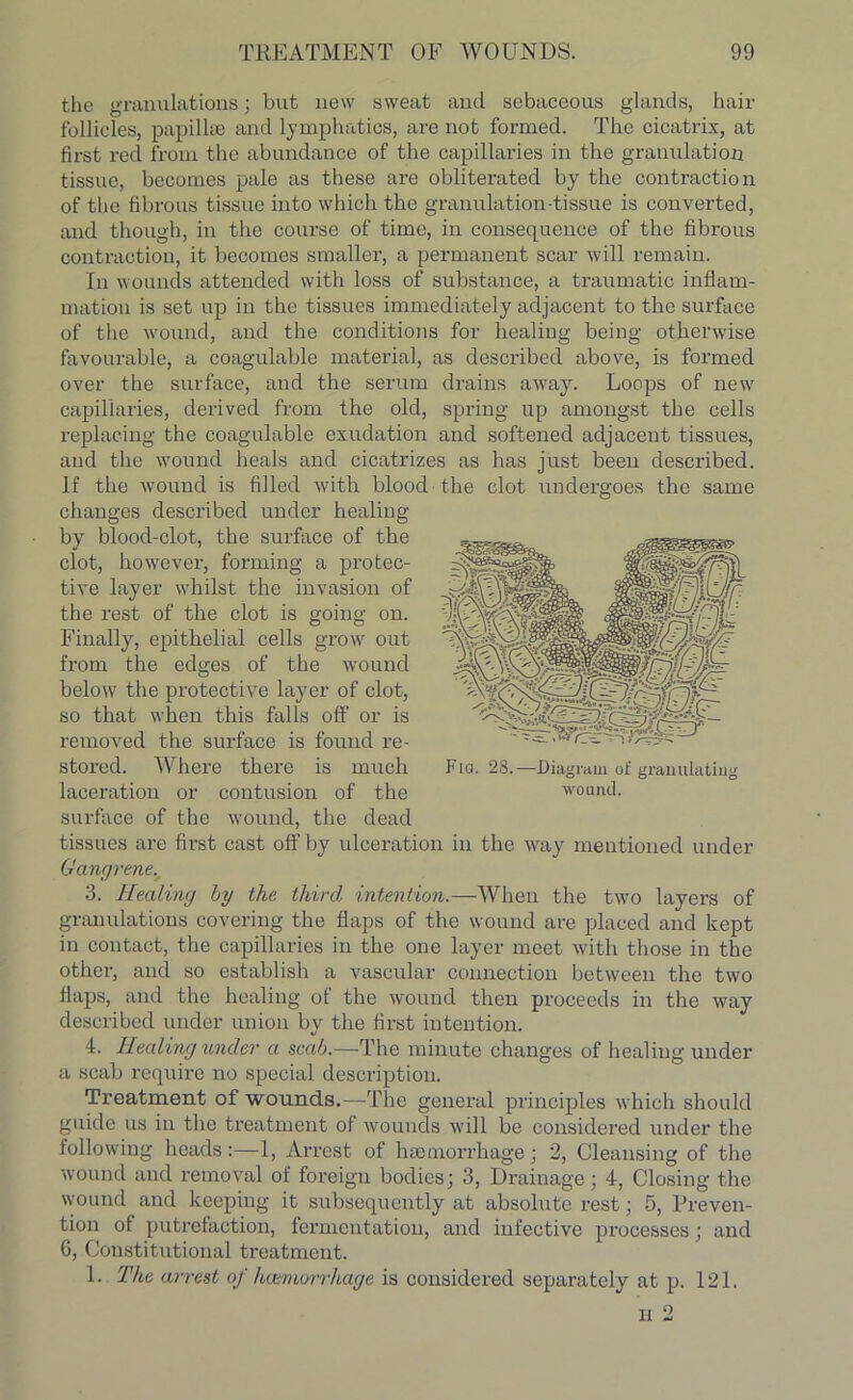 the granulations; but new sweat and sebaceous glands, hair follicles, papillae and lymphatics, are not formed. The cicatrix, at first red from the abundance of the capillaries in the granulation tissue, becomes pale as these are obliterated by the contraction of the fibrous tissue into which the granulation-tissue is converted, and though, in the course of time, in consequence of the fibrous contraction, it becomes smaller, a permanent scar will remain. In wounds attended with loss of substance, a traumatic inflam- mation is set up in the tissues immediately adjacent to the surface of the wound, and the conditions for healing being otherwise favourable, a coagulable material, as described above, is formed over the surface, and the serum drains away. Loops of new capillaries, derived from the old, spring up amongst the cells replacing the coagulable exudation and softened adjacent tissues, and the wound heals and cicatrizes as has just been described. If the wound is filled with blood the clot undergoes the same changes described under healing by blood-clot, the surface of the clot, hownver, forming a protec- tive layer whilst the invasion of the rest of the clot is going on. Finally, epithelial cells grow out from the edges of the wound below the protective layer of clot, so that when this falls off or is removed the surface is found re- stored. Where there is much laceration or contusion of the surface of the wound, the dead tissues are first cast off by ulceration in the way mentioned under Gangrene. 3. Healing by the third intention.—When the two layers of granulations covering the flaps of the wound are placed and kept in contact, the capillaries in the one layer meet with those in the other, and so establish a vascular connection between the two flaps, and the healing of the wound then proceeds in the way described under union by the first intention. 4. Healing under a scab.—The minute changes of healing under a scab require no special description. Treatment of wounds.—The general principles which should guide us in the treatment of wounds will be considered under the following heads:—1, Arrest of haemorrhage; 2, Cleansing of the wound and removal of foreign bodies; 3, Drainage; 4, Closing the wound and keeping it subsequently at absolute rest; 5, Preven- tion of putrefaction, fermentation, and infective processes; and G, Constitutional treatment. 1. The arrest of haemorrhage is considered separately at p. 121. H 2 Fia. 28.—Diagram of granulating wound.