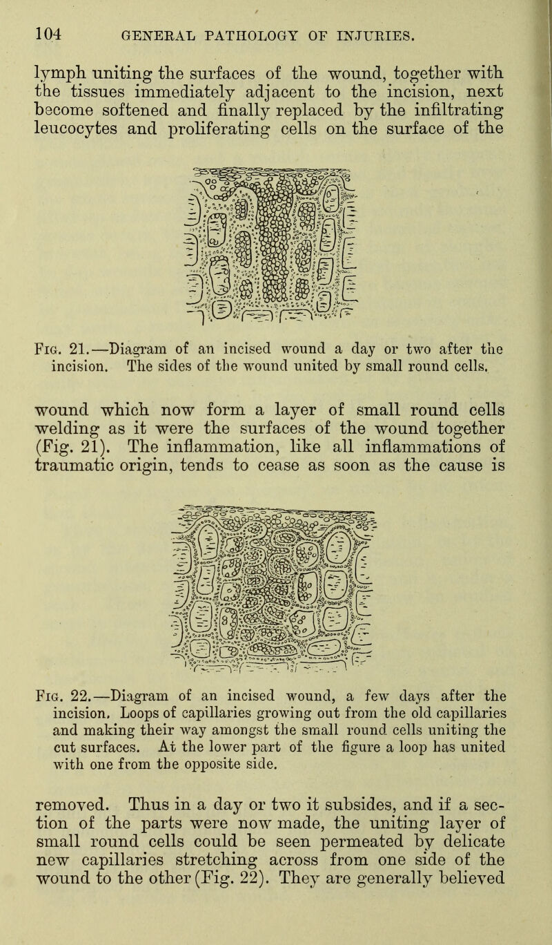 lymph, uniting the surfaces of the wound, together with the tissues immediately adjacent to the incision, next become softened and finally replaced by the infiltrating leucocytes and proliferating cells on the surface of the Fig. 21.—Diagram of an incised wound a day or two after the incision. The sides of the wound united by small round cells. wound which now form a layer of small round cells welding as it were the surfaces of the wound together (Fig. 21). The infiammation, like all inflammations of traumatic origin, tends to cease as soon as the cause is Fig. 22.—Diagram of an incised wound, a few days after the incision. Loops of capillaries growing out from the old capillaries and making their way amongst the small round cells uniting the cut surfaces. At the lower part of the figure a loop has united with one from the opposite side. removed. Thus in a day or two it subsides, and if a sec- tion of the parts were now made, the uniting layer of small round cells could be seen permeated by delicate new capillaries stretching across from one side of the wound to the other (Fig. 22). They are generally believed