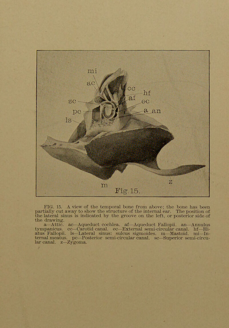 FIG. 15. A view of the temporal hone from above; the bone has been partially cut away to show the structure of the internal ear. The position of the lateral sinus is indicated by the groove on the left, or posterior side of the drawing. a—Attic, ac—Aqueduct cochlea, af—Aqueduct Fallopii. an—Annulus tympanicus. cc—Carotid canal, ec—External semi-circular caual. lif—Hi- atus Fallopii. Is—Lateral sinus: sulcus sigmoides. m—Mastoid, mi—In- ternal meatus, pc—Posterior semi-circular canal, sc—Superior semi-circu- lar canal, z—Zygoma.