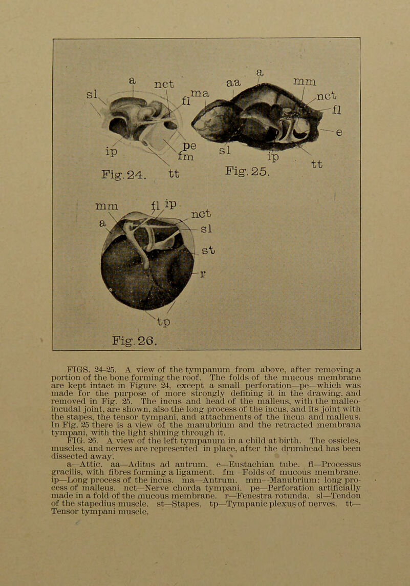 a 'tp Fig. 26. FIGS. 24-25. A view of the tympanum from above, after removing a portion of the bone forming the roof. The folds of the mucous membrane are kept intact in Figure 24, except a small perforation—pe—which was made for the purpose of more strongly defining it in the drawing, and removed in Fig. 25. The incus and head of the malleus, with the malleo- incudal joint, are shown, also the long process of the incus, and its joint with the stapes, the tensor tympani. and attachments of the incus and malleus. In Fig. 25 there is a view of the manubrium and the retracted membrana tympani, with the light shining through it. FIG. 26. A view of the left tympanum in a child at birth. The ossicles, muscles, and nerves are represented in place, after the drumhead has been dissected away. a—Attic, aa—Aditus ad antrum, e—Eustachian tube, fl—Processus gracilis, with fibres forming a ligament, fm—Folds of mucous membrane, ip—Long process of the incus, ma—Antrum, mm—Manubrium: long pro- cess of malleus, net—Nerve chorda tympani. pe—Perforation artificially made in a fold of the mucous membrane, r—Fenestra rotunda, si—Tendon of the stapedius muscle, st—Stapes, tp—Tympanic plexus of nerves, tt— Tensor tympani muscle.