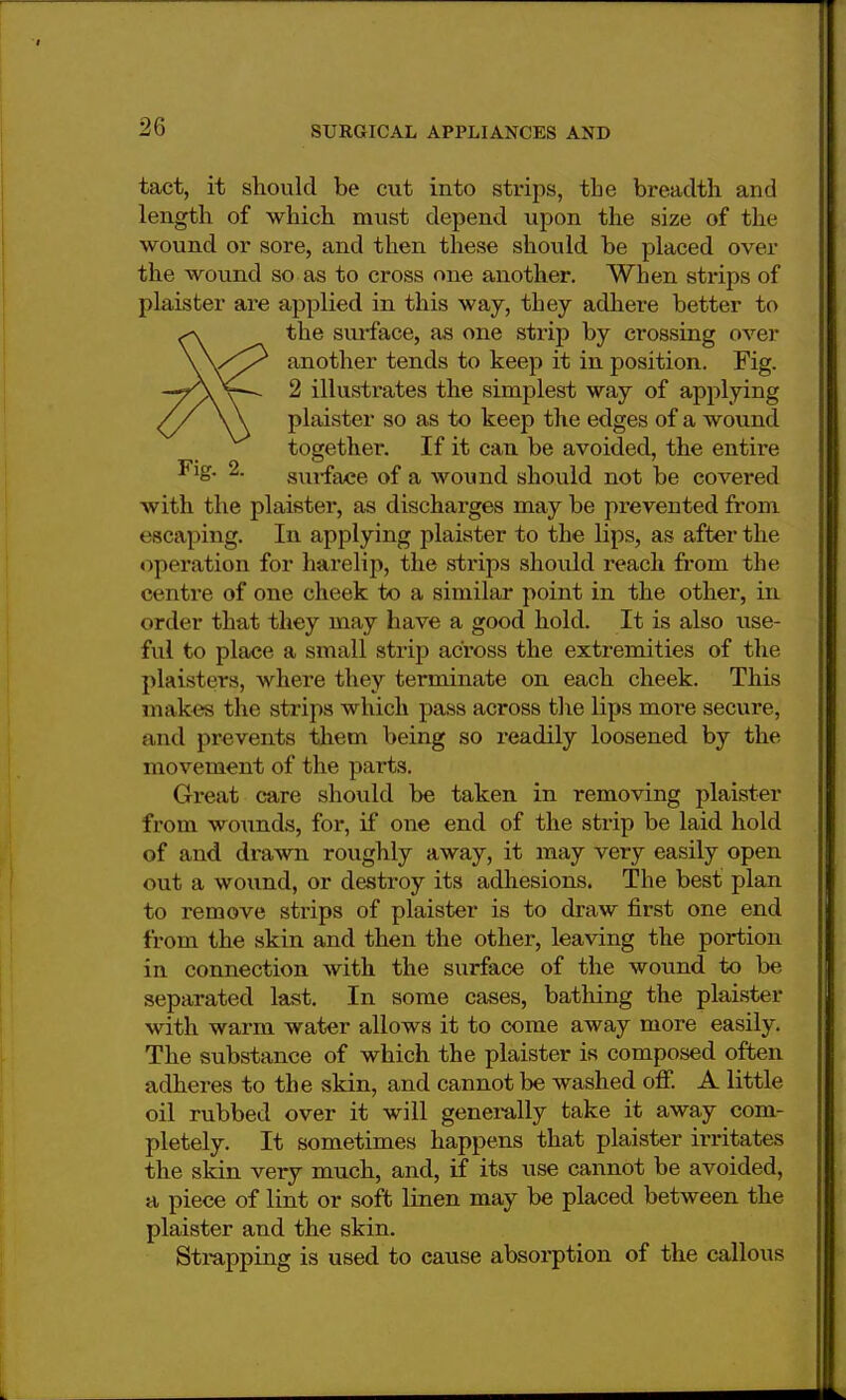 tact, it should be cut into strips, the breadth and length of which must depend upon the size of the wound or sore, and then these should be placed over the wound so as to cross one another. When strips of plaister are applied in this way, they adhere better to the surface, as one strip by crossing over another tends to keep it in position. Fig. 2 illustiutes the simplest way of applying plaister so as to keep the edges of a wound together. If it can be avoided, the entire Fig- 2. sui-face of a wound should not be covered with the plaister, as discharges may be prevented from • scaping. In applying plaister to the lips, as after the operation for harelip, the strips should reach from the i'ciitve of one cheek to a similar point in the other, in order that they may have a good hold. It is also use- ful to place a small strip across the extremities of the plaisters, where they terminate on each cheek. This makes the strips which pass across the lips more secure, and prevents them being so readily loosened by the movement of the parts. Great care should be taken in removing plaister from wounds, for, if one end of the strip be laid hold of and drawn roughly away, it may very easily open out a wound, or destroy its adhesions. The best plan to remove strips of plaister is to draw first one end from the skin and then the other, leaving the portion in connection with the surface of the wound to be separated last. In some cases, bathing the plaister with warm water allows it to come away more easily. The substance of which the plaister is composed often adheres to the skin, and cannot be washed off. A little oil rubbed over it will generally take it away com- pletely. It sometimes happens that plaister irritates the skin very much, and, if its use cannot be avoided, a piece of lint or soft linen may be placed between the plaister and the skin. Strapping is used to cause absorption of the callous