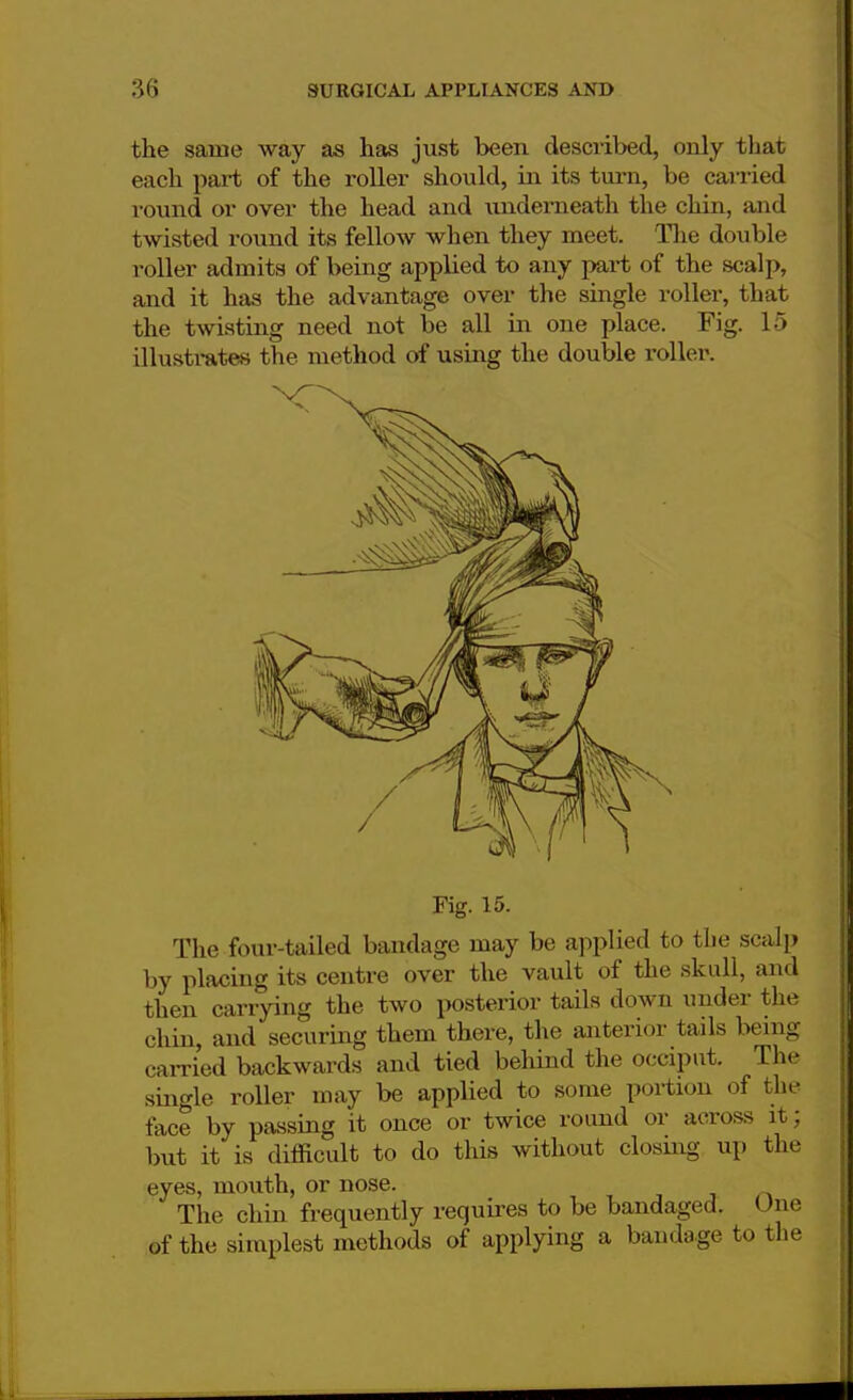 the same way as has just been described, only that each part of the roller should, in its turn, be carried round or over the head and underneath the chin, and twisted round its fellow when they meet. The double roller admits of being applied to any part of the scalp, and it has the advantage over the single roller, that the twisting need not be all in one place. Fig. 15 illustrates the method of using the double roller. Fig. 15. The four-tailed bandage may be applied to tbe scalp by placing its centre over the vault of the skull, and then carrying the two posterior tails down under the chin, and securing them there, the anterior tails being carried backwards and tied behind the occiput. The single roller may be applied to some portion of the face by passing it once or twice round or across it; but it is difficult to do this without closing up the eyes, mouth, or nose. The chin frequently requires to be bandaged. One of the simplest methods of applying a bandage to the