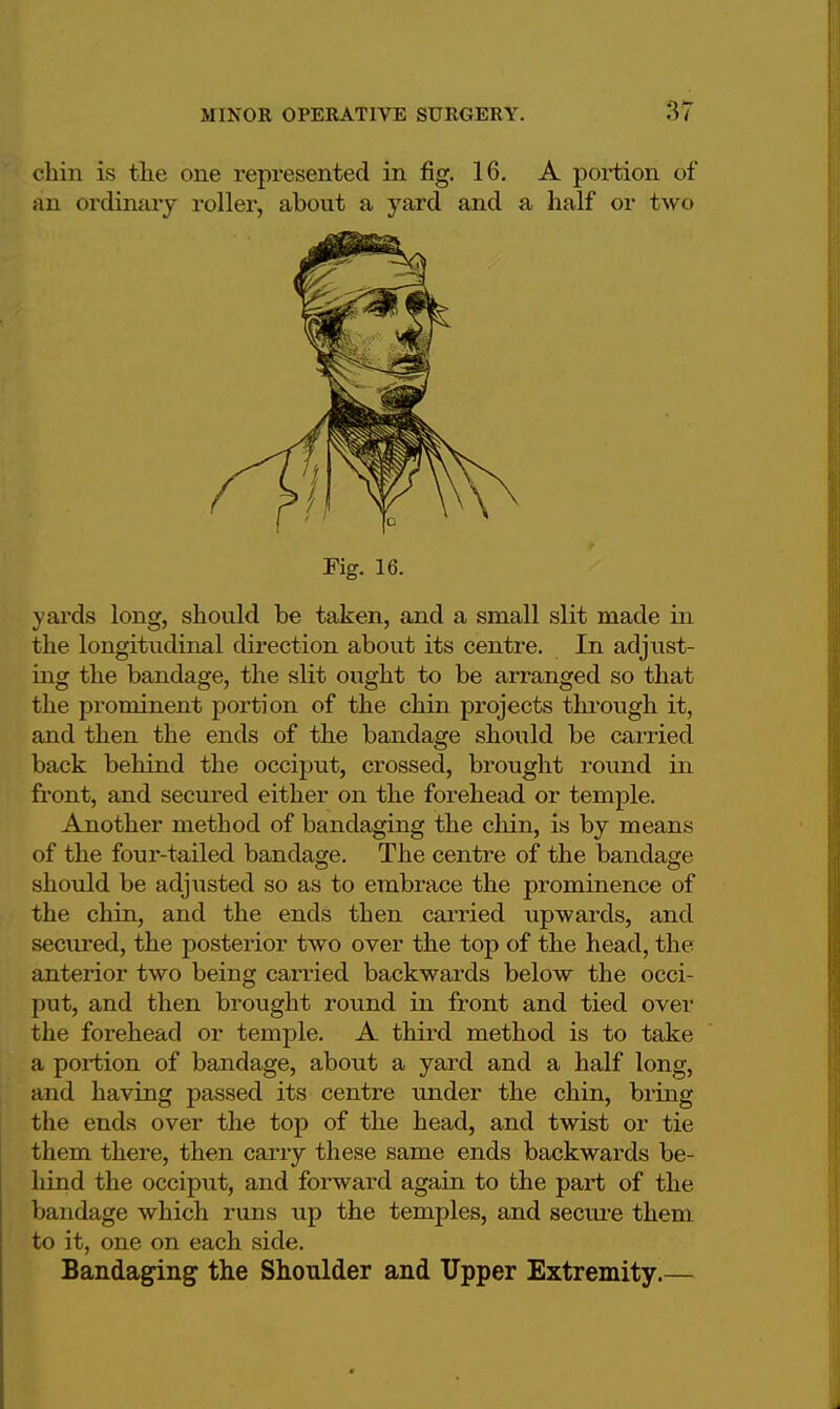 chin is the one represented in fig. 16. A portion of an ordinary roller, about a yard and a half or two Fig. 16. yards long, should be taken, and a small slit made in the longitudinal direction about its centre. In adjust- ing the bandage, the slit ought to be arranged so that the prominent portion of the chin projects through it, and then the ends of the bandage should be carried back behind the occiput, crossed, brought round in front, and secured either on the forehead or temple. Another method of bandaging the chin, is by means of the four-tailed bandage. The centre of the bandage should be adjusted so as to embrace the prominence of the chin, and the ends then earned upwards, and secured, the posterior two over the top of the head, the anterior two being carried backwards below the occi- put, and then brought round in front and tied over the forehead or temple. A third method is to take a portion of bandage, about a yard and a half long, and having passed its centre under the chin, bring the ends over the top of the head, and twist or tie them there, then carry these same ends backwards be- hind the occiput, and forward again to the part of the bandage which runs up the temples, and secure them to it, one on each side. Bandaging the Shoulder and Upper Extremity.—