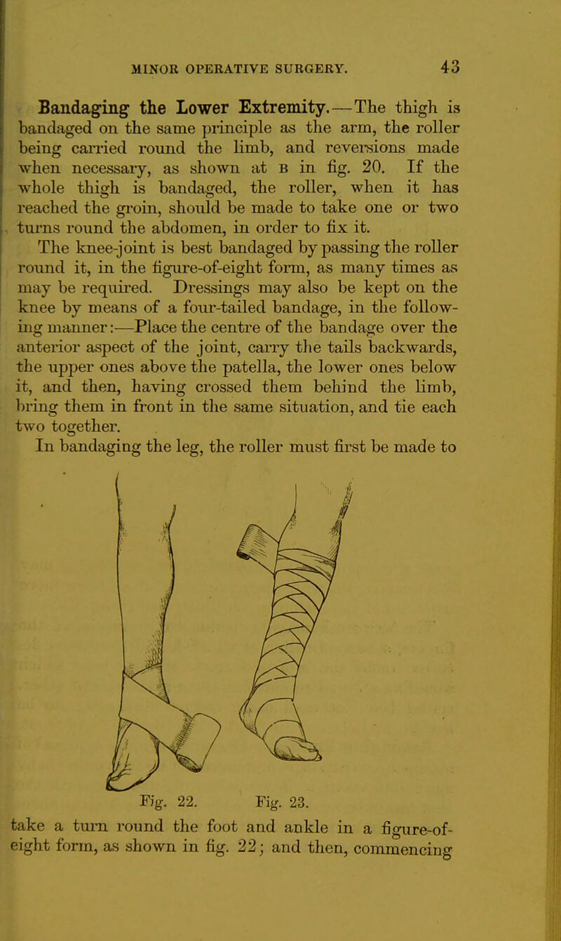 Bandaging the Lower Extremity.—The thigh is bandaged on the same principle as the arm, the roller being carried round the limb, and reversions made when necessary, as shown at b in fig. 20. If the whole thigh is bandaged, the roller, when it has reached the groin, should be made to take one or two turns round the abdomen, in order to fix it. The knee-joint is best bandaged bypassing the roller round it, in the figure-of-eight form, as many times as may be required. Dressings may also be kept on the knee by means of a four-tailed bandage, in the follow- ing manner:—-Place the centre of the bandage over the anterior aspect of the joint, carry the tails backwards, the upper ones above the patella, the lower ones below it, and then, having crossed them behind the limb, bring them in front in the same situation, and tie each two together. In bandaging the leg, the roller must first be made to Fig. 22. Fig. 23. take a turn round the foot and ankle in a figure-of- eight form, as shown in fig. 22; and then, commencing