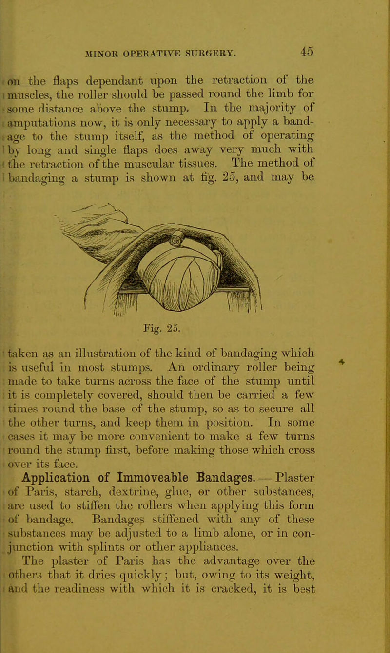 on the flaps dependant upon the retraction of the muscles, the roller should be passed round the limb for some distance above the stump. In the majority of amputations now, it is only necessary to apply a band- age to the stump itself, as the method of operating bj long and single flaps does away very much with the retraction of the muscular tissues. The method of bandaging a stump is shown at fig. 25, and may be Fig. 25. taken as an illustration of the kind of bandaging which is useful in most stumps. An ordinary roller being made to take turns across the face of the stump until it is completely covered, should then be carried a few times round the base of the stump, so as to secure all the other turns, and keep them in position. In some cases it may be more convenient to make a few turns round the stump first, before making those which cross I over its face. Application of Immoveable Bandages. — Plaster of Paris, starch, dextrine, glue, ©r other substances, are used to stiffen the rollers when applying this form of bandage. Bandages stiffened with any of these substances may be adjusted to a limb alone, or in con- , junction with splints or other appliances. The plaster of Paris has the advantage over the others that it dries quickly; but, owing to its weight, and the readiness with which it is cracked, it is best