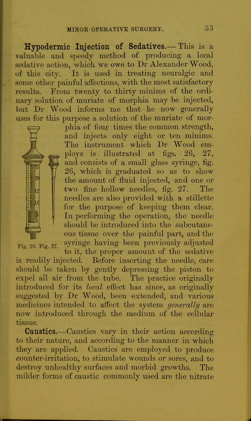 Hypodermic Injection of Sedatives.— This is a valuable and speedy method of producing a local sedative action, which we owe to Dr Alexander Wood, of this city. It is used in treating neuralgic and some other painful affections, with the most satisfactory results. From twenty to thirty minims of the ordi- nary solution of muriate of morphia may be injected, but Dr Wood informs me that he now generally uses for this purpose a solution of the muriate of mor- phia of four times the common strength, and injects only eight or ten minims. The instrument which Dr Wood em- ploys is illustrated at figs. 26, 27, and consists of a small glass syringe, fig. 26, which is graduated so as to show the amount of fluid injected, and one or two fine hollow needles, fig. 27. The needles are also provided with a stillette for the purpose of keeping them clear. In performing the operation, the needle should be introduced into the subcutane- ous tissue over the painful part, and the syringe having been previously adjusted to it, the proper amount of the sedative is readily injected. Before inserting the needle, care should be taken by gently depressing the piston to expel all air from the tube. The practice originally introduced for its local effect has since, as originally suggested by Dr Wood, been extended, and various medicines intended to affect the system generally are now introduced through the medium of the cellular tissue. Caustics.—Caustics Fig. 26. Fig. 27. according vary in their action to their nature, and according to the manner in which they are applied. Caustics are employed to produce counter-irritation, to stimulate wounds or sores, and to destroy unhealthy surfaces and morbid growths. The milder forms of caustic commonly used are the nitrate