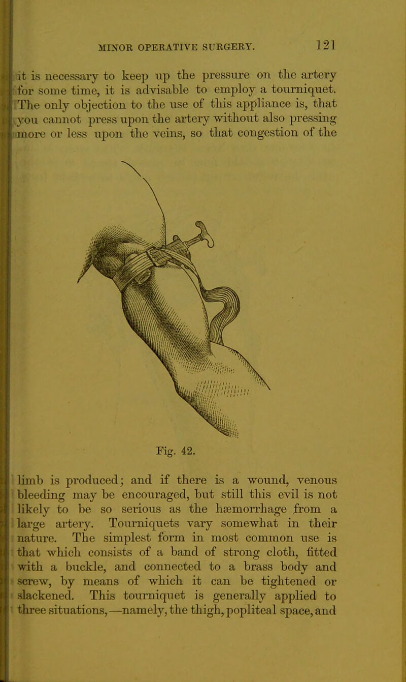 it is necessaiy to keep up the pressure on the artery for some time, it is advisable to employ a tourniquet. The only objection to the use of this appliance is, that ou cannot press upon the artery withoiit also pressing ore or less upon the veins, so that congestion of the Fig. 42. limb is produced; and if there is a wound, venous bleeding may be encouraged, but still this evil is not likely to be so serious as the haemorrhage from a large artery. Tourniquets vary somewhat in their nature. The simplest form in most common use is that which consists of a band of strong cloth, fitted with a buckle, and connected to a brass body and screw, by means of which it can be tightened or slackened. This tourniquet is generally applied to three situations, —namely, the thigh, popliteal space, and