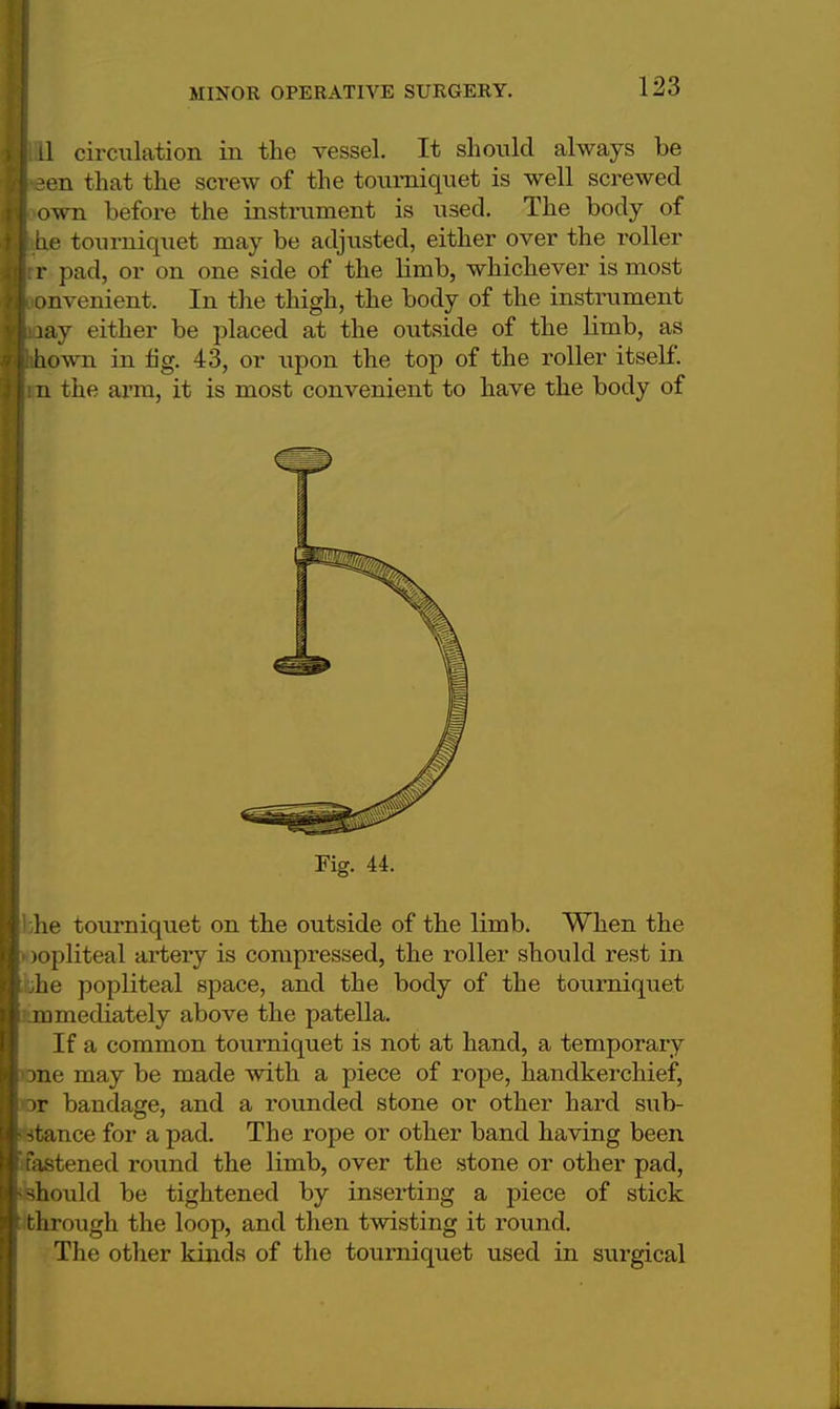 11 circulation in the vessel. It should always be en that the screw of the tourniquet is well screwed own before the instrument is used. The body of he tourniquet may be adjusted, either over the roller r pad, or on one side of the limb, whichever is most onvenient. In the thigh, the body of the instrument lay either be placed at the outside of the limb, as hown in tig. 43, or upon the top of the roller itself, n the arm, it is most convenient to have the body of Fig. 44. lie tourniquet on the outside of the limb. When the lopliteal artery is compressed, the roller should rest in iihe popliteal space, and the body of the tourniquet jjnmediately above the patella. If a common tourniquet is not at hand, a temporary •one may be made with a piece of rope, handkerchief, or bandage, and a rounded stone or other hard sub- stance for a pad. The rope or other band having been fastened round the limb, over the stone or other pad, 'fchoxild be tightened by inserting a piece of stick through the loop, and then twisting it round. The other kinds of the tourniquet used in surgical