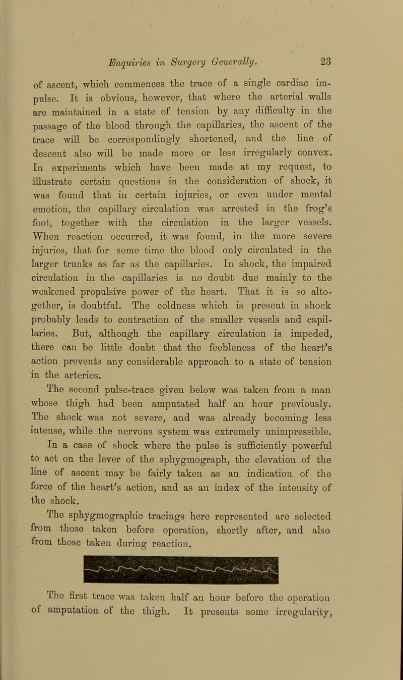 of ascent, which commences the trace of a single cardiac im- pulse. It is obvious, however, that where the arterial walls are maintained in a state of tension by any difficulty in the passage of the blood through the capillaries, the ascent of the trace will be correspondingly shortened, and the line of descent also will be made more or less irregularly convex. In experiments which have been made at my request, to illustrate certain questions in the consideration of shock, it was found that in certain injuries, or even under mental emotion, the capillary circulation was arrested in the frog’s foot, together with the circulation in the larger vessels. When reaction occurred, it was found, in the more severe injuries, that for some time the blood only circulated in the larger trunks as far as the capillaries. In shock, the impaired circulation in the capillaries is no doubt due mainly to the weakened propulsive power of the heart. That it is so alto- gether, is doubtful. The coldness which is present in shock probably leads to contraction of the smaller vessels and capil- laries. But, although the capillary circulation is impeded, there can be little doubt that the feebleness of the heart’s action prevents any considerable approach to a state of tension in the arteries. The second pulse-trace given below was taken from a man whose thigh had been amputated half an hour previously. The shock was not severe, and was already becoming less intense, while the nervous system was extremely unimpressible. In a case of shock where the pulse is sufficiently powerful to act on the lever of the sphygmograph, the elevation of the line of ascent may be fairly taken as an indication of the force of the heart’s action, and as an index of the intensity of the shock. The sphygmographic tracings here represented are selected from those taken before operation, shortly after, and also from those taken during reaction. The first traco was taken half an hour before the operation ol amputation of tho thigh. It presents some irregularity,