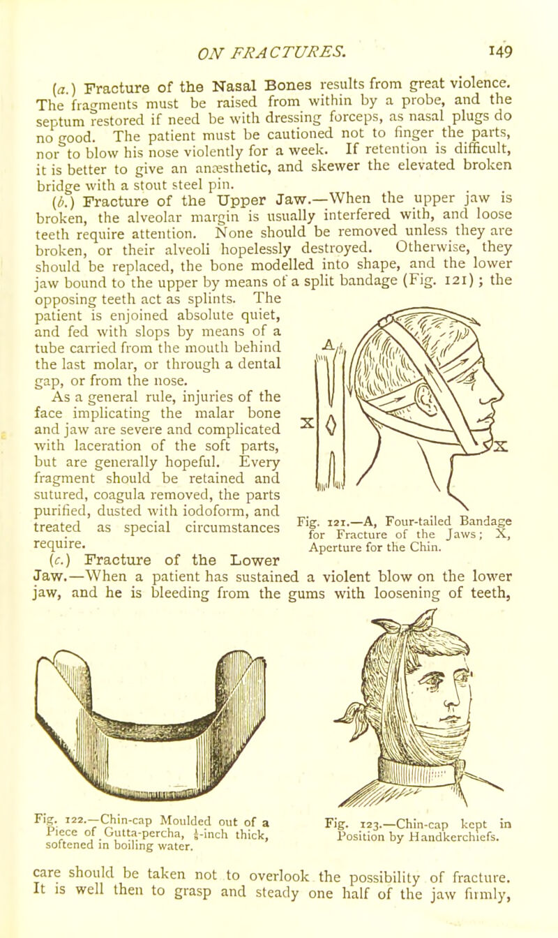 [a.) Fracture of the Nasal Bones results from great violence. The frat^ments must be raised from within by a probe, and the septum restored if need be with dressing forceps, as nasal plugs do no good. The patient must be cautioned not to finger the parts, nor to blow his nose violently for a week. If retention is difficult, it is better to give an anesthetic, and skewer the elevated broken bridge with a stout steel pin. (/;.) Fracture of the Upper Jaw.—When the upper jaw is broken, the alveolar margin is usually interfered with, and loose teeth require attention. None should be removed unless they are broken, or their alveoli hopelessly destroyed. Otherwise, they should be replaced, the bone modelled into shape, and the lower jaw bound to the upper by means of a split bandage (Fig. 121); the opposing teeth act as splints. The patient is enjoined absolute quiet, and fed with slops by means of a tube carried from the mouth behind the last molar, or through a dental gap, or from the nose. As a general rule, injuries of the face implicating the malar bone and jaw are severe and complicated with laceration of the soft parts, but are generally hopeful. Every fragment should be retained and sutured, coagula removed, the parts purified, dusted with iodoform, and treated as special circumstances require. (c.) Fracture of the Lower Jaw.—When a patient has sustained a violent blow on the lower jaw, and he is bleeding from the gums with loosening of teeth, 0 Fig. lai.—A, Four-tailed Bandage for Fracture of the Jaws; X, Aperture for the Chin. Fig. 122.—Chin-cap Moulded out of a Piece of Gutta-percha, J-inch thick, softened in boiling water. Fig. 123.—Chin-cap kept in Position by Handkerchiefs. care should be taken not to overlook the possibility of fracture. It is well then to grasp and steady one half of the jaw fivmly,