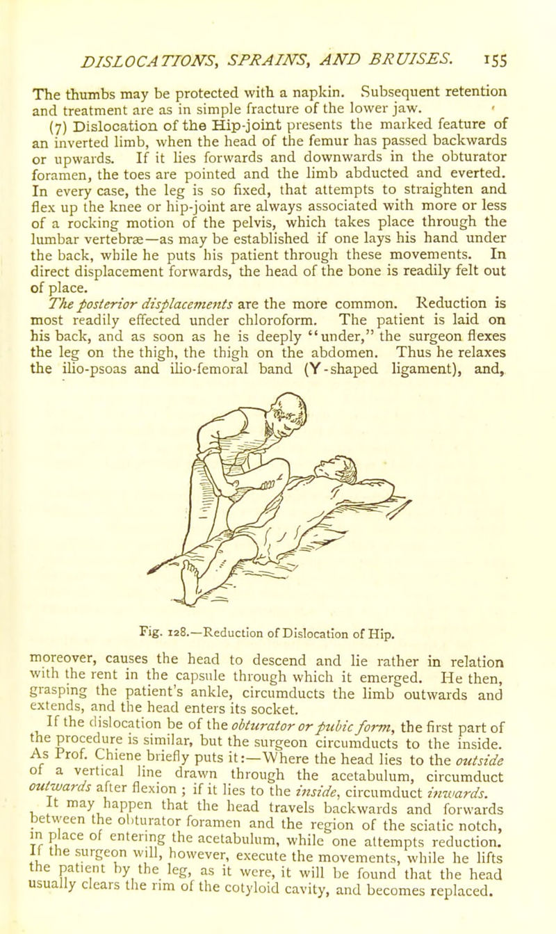 The thvnnbs may be protected with a napkin. Subsequent retention and treatment are as in simple fracture of the lower jaw. (7) Dislocation of the Hip-joint presents the marked feature of an inverted limb, when the head of the femur has passed backwards or upwards. If it lies forwards and downwards in the obturator foramen, the toes are pointed and the limb abducted and everted. In every case, the leg is so fixed, that attempts to straighten and flex up the knee or hip-joint are always associated with more or less of a rocking motion of the pelvis, which takes place through the lumbar vertebrae—as may be established if one lays his hand under the back, while he puts his patient through these movements. In direct displacement forwards, the head of the bone is readily felt out of place. Tke posterior displacements are the more common. Reduction is most readily effected under chloroform. The patient is laid on his back, and as soon as he is deeply under, the surgeon flexes the leg on the thigh, the thigh on the abdomen. Thus he relaxes the ilio-psoas and iUo-femoral band (Y-shaped Ugament), and, Fig. 128.—Reduction of Dislocation of Hip. moreover, causes the head to descend and lie rather in relation with the rent in the capsule through which it emerged. He then, graspmg the patient's ankle, circumducts the limb outwards and extends, and the head enters its socket. If the dislocation be of the obturator or pubic form, the first part of the procedure is similar, but the surgeon circumducts to the inside. As Prof. Chiene briefly puts it:—Where the head lies to the outside of a vertical Ime drawn through the acetabulum, circumduct outwards after flexion ; if it lies to the inside, circumduct imvards. it may happen that the head travels backwards and forwards between the ol.turator foramen and the region of the sciatic notch, in place of entering the acetabulum, while one attempts reduction. II the surgeon will, however, execute the movements, while he lifts the patient by the leg, as it were, it will be found that the head usually clears the rim of the cotyloid cavity, and becomes replaced.