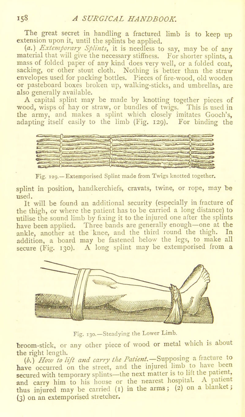 The great secret in handling a fractured limb is to keep up extension upon it, until the splints be applied. [a.) Extemporary Splints, it is needless to say, may be of any material that will give the necessary stiffness. For shorter splints, a mass of folded paper of any kind does very well, or a folded coat, sacking, or other stout cloth. Nothing is better than the straw envelopes used for packing bottles. Pieces of fire-wood, old wooden or pasteboard boxes broken up, walking-sticks, and umbrellas, are also generally available. A capital splint may be made by knotting together pieces of wood, wisps of hay or straw, or bundles of twigs. This is used in the army, and makes a splint which closely imitates Gooch's, adapting itself easily to the limb (Fig. 129). For binding the Fig. 129.—Extemporised Splint made from Twigs knotted together. splint in position, handkerchiefs, cravats, twine, or rope, may be used. It will be found an additional security (especially in fracture of the thigh, or where the patient has to be carried a long distance) to utilise the sound limb by fixing it to the injured one after the splints have been applied. Three bands are generally enough—one at the ankle, another at the knee, and the third round the thigh. In addition, a board may be fastened below the legs, to make all secure (Fig. 130). A long splint may be extemporised from a Fig. 130.—Steadying the Lower Limb. broom-stick, or any other piece of wood or metal which is about the right length. (/;.) H01V to lift and carry the P^j^/fiWi?.—Supposing a fracture to have occurred on the street, and the injured limb to have been secured with temporary splints—the next matter is to lift the patient, and carry him to his house or the nearest hospital. A patient thus injured may be carried (i) in the arms; (2) on a blanket;